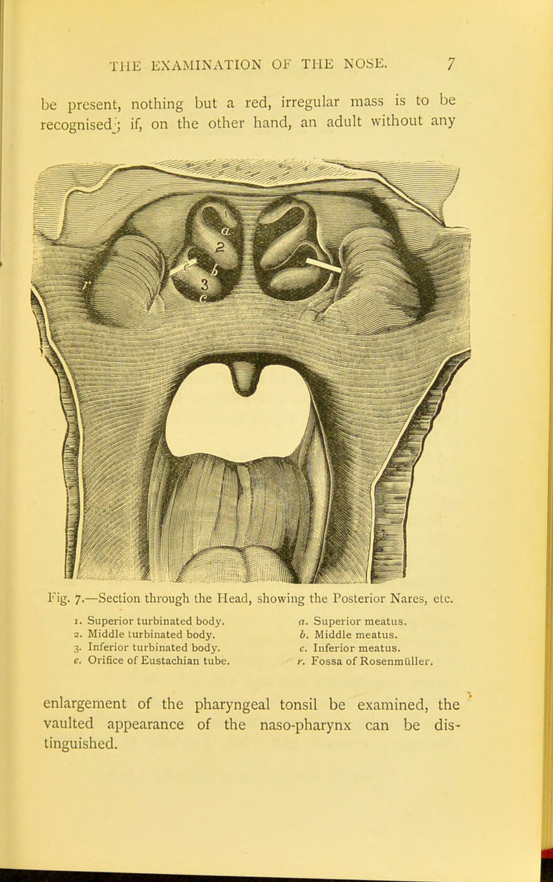 be present, nothing but a red, irregular mass is to be recognised'; if, on the other hand, an adult without any lr'g- 7-—Section through the Head, showing the Posterior Nares, etc. 1. Superior turbinated body. a. Superior meatus. 2. Middle turbinated body. b. Middle meatus. 3. Inferior turbinated body. c. Inferior meatus. c. Orifice of Eustachian tube. r. Fossa of Rosenmuller. enlargement of the pharyngeal tonsil be examined, the vaulted appearance of the naso-pharynx can be dis- tinguished.