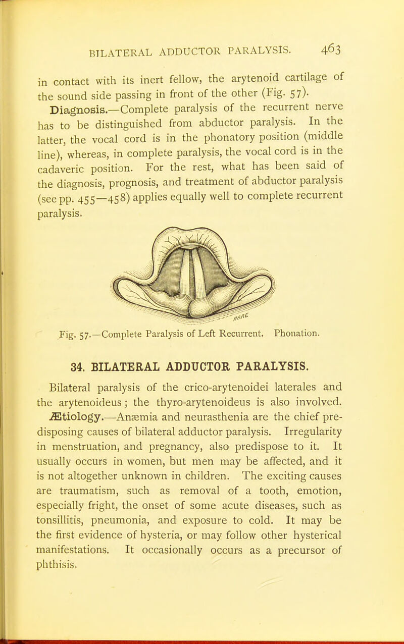 in contact with its inert fellow, the arytenoid cartilage of the sound side passing in front of the other (Fig. 57). Diagnosis—Complete paralysis of the recurrent nerve has to be distinguished from abductor paralysis. In the latter, the vocal cord is in the phonatory position (middle line), whereas, in complete paralysis, the vocal cord is in the cadaveric position. For the rest, what has been said of the diagnosis, prognosis, and treatment of abductor paralysis (see pp. 455—458) applies equally well to complete recurrent paralysis. Fig. 57.—Complete Paralysis of Left Recurrent. Phonation. 34. BILATERAL ADDUCTOR PARALYSIS. Bilateral paralysis of the crico-arytenoidei laterales and the arytenoideus; the thyro-arytenoideus is also involved. etiology.—Anaemia and neurasthenia are the chief pre- disposing causes of bilateral adductor paralysis. Irregularity in menstruation, and pregnancy, also predispose to it. It usually occurs in women, but men may be affected, and it is not altogether unknown in children. The exciting causes are traumatism, such as removal of a tooth, emotion, especially fright, the onset of some acute diseases, such as tonsillitis, pneumonia, and exposure to cold. It may be the first evidence of hysteria, or may follow other hysterical manifestations. It occasionally occurs as a precursor of phthisis.