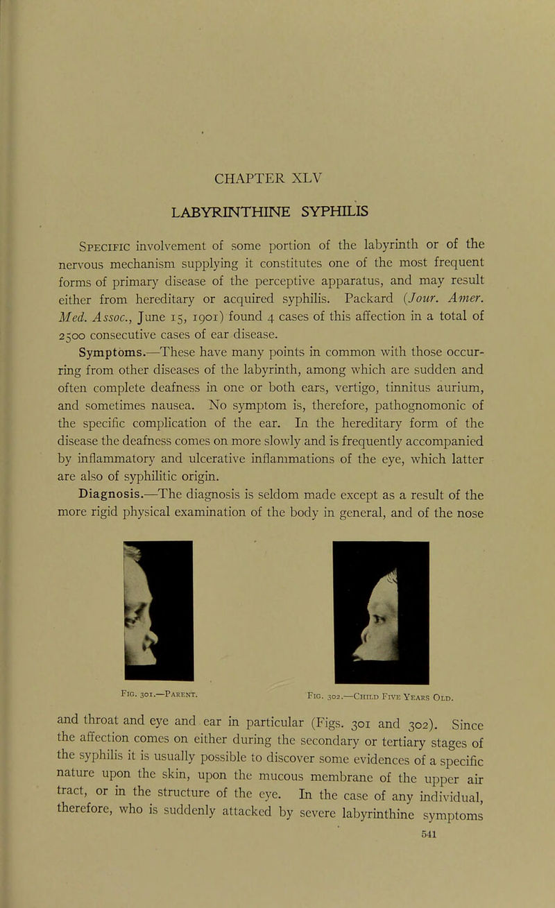 LABYRINTHINE SYPHILIS Specific involvement of some portion of the labyrinth or of the nervous mechanism supplying it constitutes one of the most frequent forms of primary disease of the perceptive apparatus, and may result either from hereditary or acquired syphilis. Packard (Jour. Amer. Med. Assoc., June 15, 1901) found 4 cases of this affection in a total of 2500 consecutive cases of ear disease. Symptoms.—These have many points in common with those occur- ring from other diseases of the labyrinth, among which are sudden and often complete deafness in one or both ears, vertigo, tinnitus aurium, and sometimes nausea. No symptom is, therefore, pathognomonic of the specific complication of the ear. In the hereditary form of the disease the deafness comes on more slowly and is frequently accompanied by inflammatory and ulcerative inflammations of the eye, which latter are also of syphilitic origin. Diagnosis.—The diagnosis is seldom made except as a result of the more rigid physical examination of the body in general, and of the nose i Fig. 301.—Parent. Fic. 302.—Child Five Years Old. and throat and eye and ear in particular (Figs. 301 and 302). Since the affection comes on either during the secondary or tertiary stages of the syphilis it is usually possible to discover some evidences of a specific nature upon the skin, upon the mucous membrane of the upper air tract, or in the structure of the eye. In the case of any individual, therefore, who is suddenly attacked by severe labyrinthine symptoms