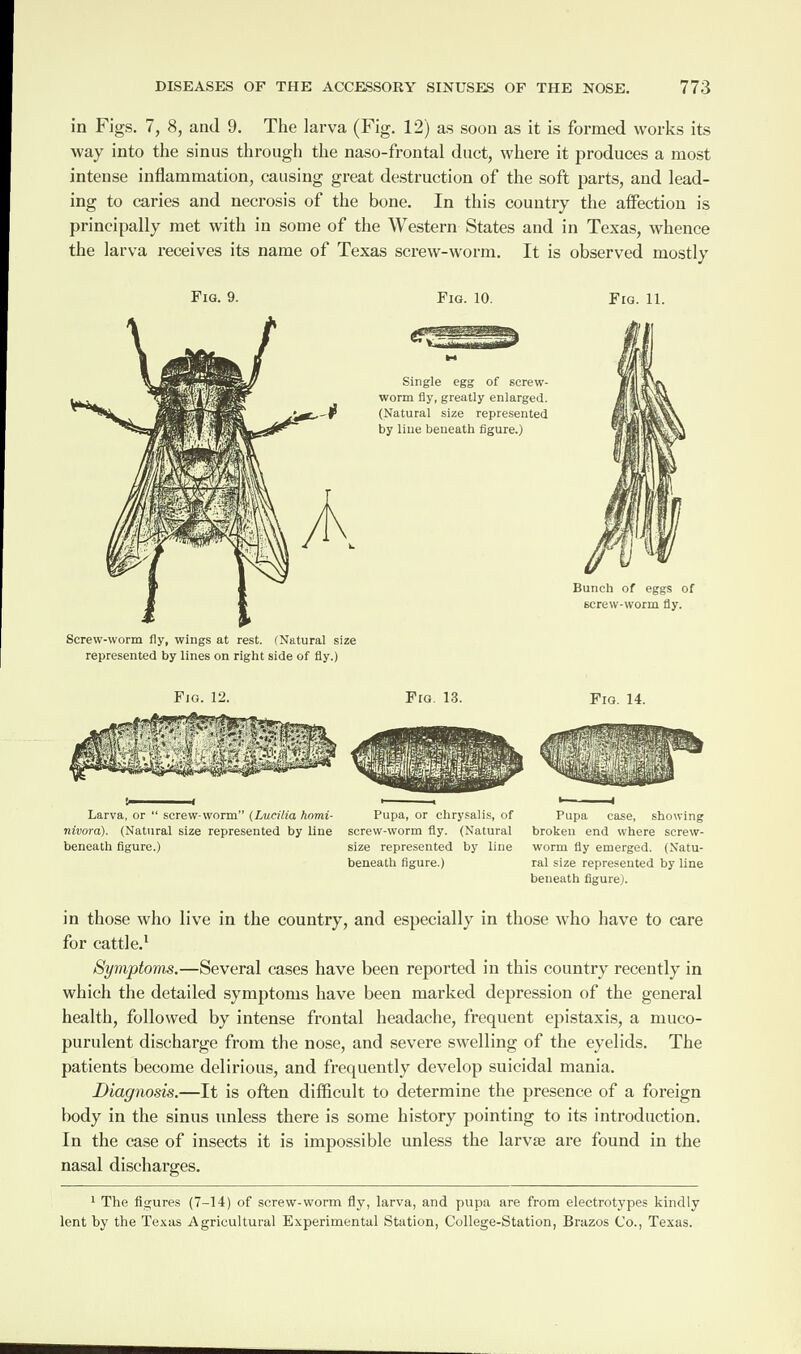 in Figs. 7, 8, and 9. The larva (Fig. 12) as soon as it is formed works its way into the sinus through the naso-frontal duct, where it produces a most intense inflammation, causing great destruction of the soft parts, and lead¬ ing to caries and necrosis of the bone. In this country the affection is principally met with in some of the Western States and in Texas, whence the larva receives its name of Texas screw-worm. It is observed mostly Fig. 9. Screw-worm fly, wings at rest. (Natural size represented by lines on right side of fly.) Fig. 10. Single egg of screw- worm fly, greatly enlarged. (Natural size represented by line beneath figure.) Fig. 11. Bunch of eggs of screw-worm fly. Fig. 12. Fig. 13. Fig. 14. Larva, or “ screw-worm” (Lucilia hnmi- Pupa, or chrysalis, of Pupa case, showing nivora). (Natural size represented by line screw-worm fly. (Natural broken end where screw- beneath figure.) size represented by line worm fly emerged. (Natu- beneath figure.) ral size represented by line beneath figure). in those who live in the country, and especially in those who have to care for cattle.1 Symptoms.—Several cases have been reported in this country recently in which the detailed symptoms have been marked depression of the general health, followed by intense frontal headache, frequent epistaxis, a muco¬ purulent discharge from the nose, and severe swelling of the eyelids. The patients become delirious, and frequently develop suicidal mania. Diagnosis.—It is often difficult to determine the presence of a foreign body in the sinus unless there is some history pointing to its introduction. In the case of insects it is impossible unless the larva; are found in the nasal discharges. 1 The figures (7-14) of screw-worm fly, larva, and pupa are from electrotypes kindly lent by the Texas Agricultural Experimental Station, College-Station, Brazos Co., Texas.