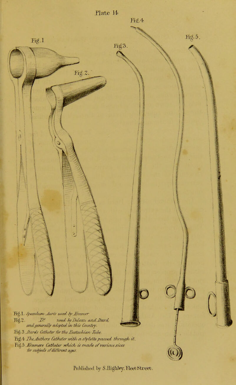 i'late J4 K^. 3 JiaroLr Catfu^ fir tJie ^'ustacfua/v Tuie: Tig'.4 Tfie^tThirs CathetrrintJi coslyfMepassed thivu^hit. .£nimers Catfieter w/urA is ma/ie ofm/iwssues for xnhjtds cFtUffennl uffe.r. Piihlisliod ty S.Eigh]iy, Fleet Sti-eet.,