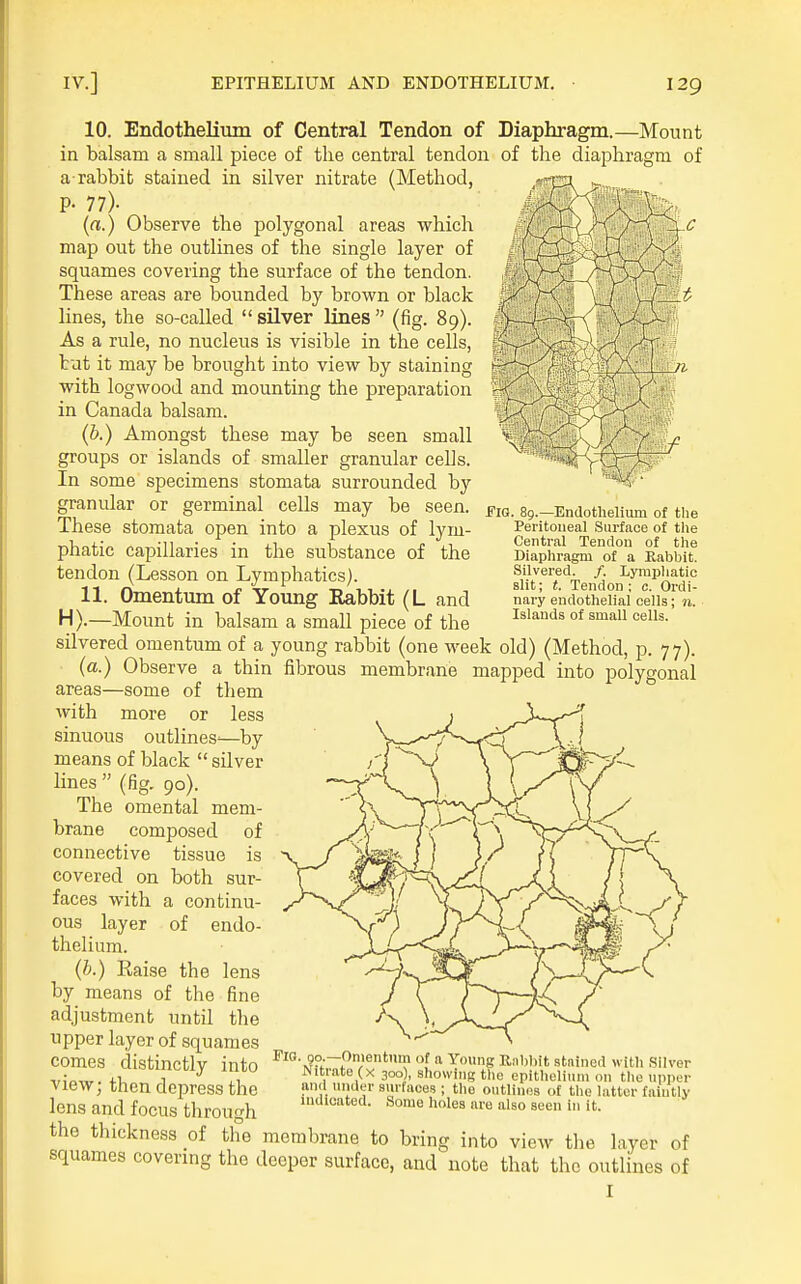 Fig. 8g.—Endothelium of the Peritoueal Surface of tlie Central Tendon of the Diaphragm of a Kabbit. Silvered. /. Lymphatic slit; t. Tendon; c. Ordi- nary endothelial cells; n. Islands of small cells. 10. Endothelium of Central Tendon of Diaphragm.—Mount in balsam a small piece of the central tendon of the diaphragm of a rabbit stained in silver nitrate (Method, P- 77). (rt.) Observe the polygonal areas which map out the outlines of the single layer of squames covering the surface of the tendon. These areas are bounded by brown or black lines, the so-called  silver lines  (fig. 89). As a rule, no nucleus is visible in the cells, tut it may be brought into view by staining with logwood and mounting the preparation in Canada balsam. (b.) Amongst these may be seen small groups or islands of smaller granular cells. In some specimens stomata surrounded by granular or germinal cells may be seen. These stomata open into a plexus of lym- phatic capillaries in the substance of the tendon (Lesson on Lymphatics). 11. Omentum of Yomig Eabbit (L and H).—Mount in balsam a small piece of the silvered omentum of a young rabbit (one week old) (Method, p. 77). (a.) Observe a thin fibrous membrane mapped into polygonal areas—some of them with more or less sinuous outlines'—by means of black  silver lines  (fig. 90). The omental mem- brane composed of connective tissue is covered on both sur- faces with a continu- ous layer of endo- thelium. (h.) Raise the lens by means of the fine adjustment until the upper layer of squames comes distinctly into view; then depress the lens and focus through the thickness of the membrane to bring into view the layer of squames covering the deeper surface, and note that the outlines of Fig. 90.—Omentum of a Young llabbit stained with Sliver JNitrate (x 300), showhig the epithelium on tlie upper and under surfaces ; the outlines of the latter faintly Some holes are also seen in it. indicated.