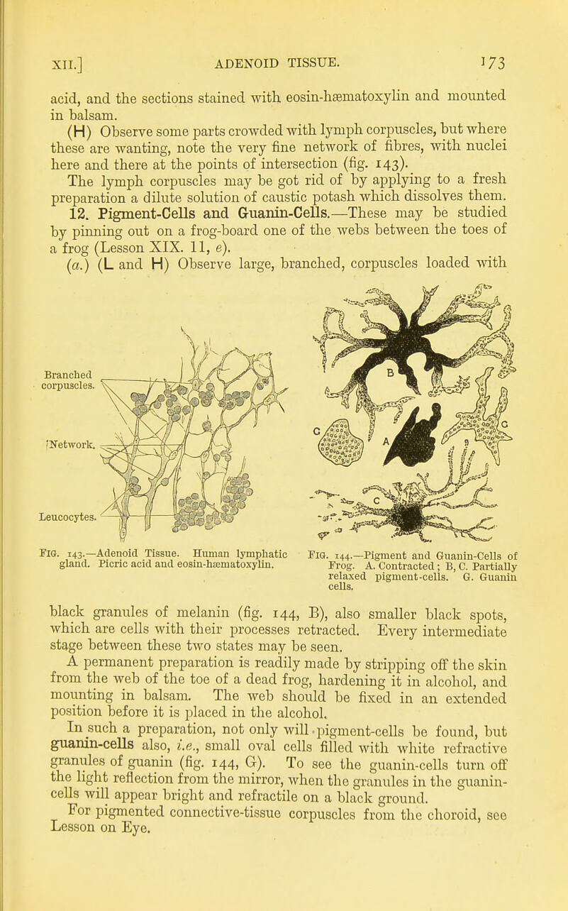 acid, and the sections stained with eosin-hsmatoxylin and mounted in balsam. (H) Observe some parts crowded with lymph corpuscles, but where these are wanting, note the very fine network of fibres, with nuclei here and there at the points of intersection (fig. 143). The lymph corpuscles may be got rid of by applying to a fresh preparation a dilute solution of caustic potash which dissolves them. 12. Pigment-Cells and Guanin-Cells.—These may be studied by pinning out on a frog-board one of the webs between the toes of a frog (Lesson XIX. 11, e). (a.) (L and H) Observe large, branched, corpuscles loaded with Branched corpuscles. 'Network. leucocytes. Fig. 143.—Adenoid Tissue. Human lympliatic gland. Picric acid and eosin-hsomatoxylin. Fig. 144.—Pigment and Guauin-Cells of Frog. A. Contracted; B, C. PartiaUy relaxed pigment-cells. G. Guanin cells. black granules of melanin (fig. 144, B), also smaller black spots, which are cells with their processes retracted. Every intermediate stage between these two states may be seen. A permanent preparation is readily made by stripping off the skin from the web of the toe of a dead frog, hardening it in alcohol, and mounting in balsam. The web should be fixed in an extended position before it is placed in the alcohol. In such a preparation, not only will-pigment-cells be found, but guanin-cells also, i.e., small oval cells filled with white refractive granules of guanin (fig. 144, G). To see the guanin-cells turn off the light reflection from the mirror, when the granules in the guanin- cells will appear bright and refractile on a black ground. For pigmented connective-tissue corpuscles from the choroid, see Lesson on Eye.