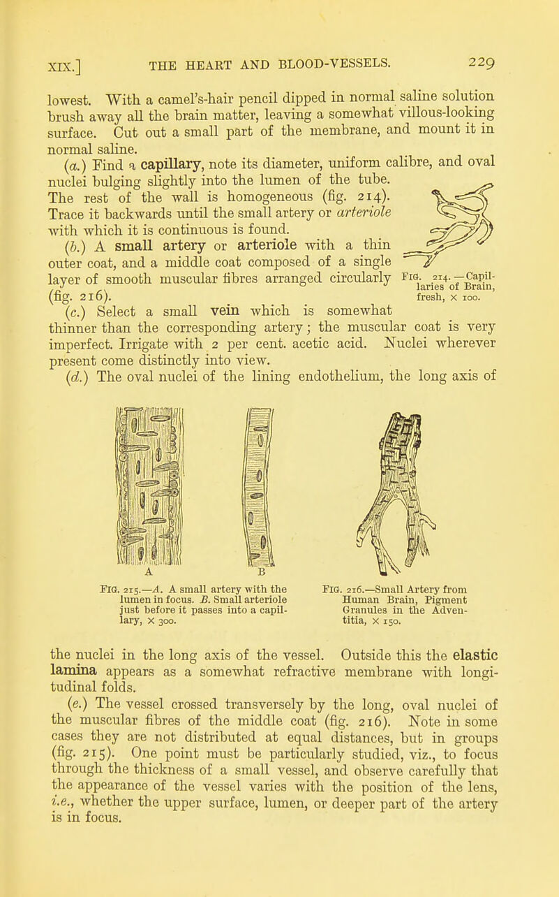 lowest. With a camel's-hair pencil dipped ia normal saline solution brush away all the brain matter, leaving a somewhat villous-looking surface. Cut out a small part of the membrane, and mount it in normal saline. (a.) Find a capillary, note its diameter, uniform calibre, and oval nuclei bulging slightly into the lumen of the tube. The rest of the wall is homogeneous (fig. 214). Trace it backwards until the small artery or arteriole with which it is continuous is found. (b.) A small artery or arteriole with a thin outer coat, and a middle coat composed of a single laver of smooth muscular fibres arranged circularly Fig. 214. —Capii- ° lanes of Bram, (fig. 216). fresh, X 100. (c.) Select a small vein which is somewhat thinner than the corresponding artery; the muscular coat is very imperfect. Irrigate with 2 per cent, acetic acid. Nuclei wherever present come distinctly into view. (d.) The oval nuclei of the lining endothelium, the long axis of the nuclei in the long axis of the vessel. Outside this the elastic lamina appears as a somewhat refractive membrane with longi- tudinal folds. (e.) The vessel crossed transversely by the long, oval nuclei of the muscular fibres of the middle coat (fig. 216). Note in some cases they are not distributed at equal distances, but in groups (fig- 215). One point must be particularly studied, viz., to focus through the thickness of a small vessel, and observe carefully that the appearance of the vessel varies with the position of the lens, i.e., whether the upper surface, lumen, or deeper part of the artery is in focus.