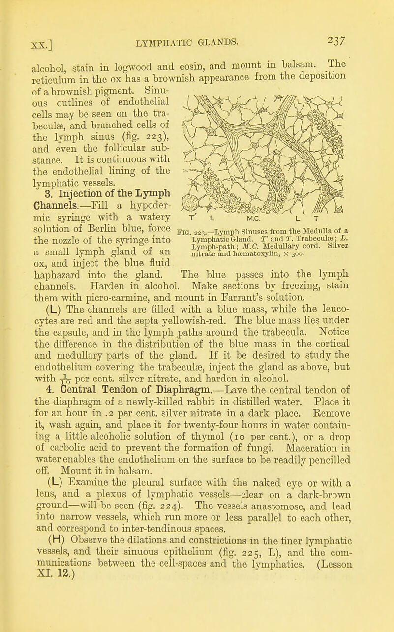 Fig. 223.—Lymph Sinuses from the Medulla of a Lymphatic Gland. T and T. Trabeculfe; L. Lymph-path; M.C. Medullary cord. Silver nitrate and hsematoxylin, x 300. alcohol, stain in logwood and eosin, and mount in balsam. The reticulum in the ox has a brownish appearance from the deposition of a brownish pigment. Sinu- ous outlines of endothelial cells may be seen on the tra- beculse, and branched cells of the lymph sinus (fig. 223), and even the follicular sub- stance. It is continuous with the endothelial lining of the lymphatic vessels. 3. Injection of the Lymph Chaimels.—Fill a hypoder- mic syringe with a watery solution of Berlin blue, force the nozzle of the syringe into a small lymph gland of an ox, and inject the blue fluid haphazard into the gland. The blue passes into the lymph channels. Harden in alcohol. Make sections by freezing, stain them with picro-carmine, and mount in Tarrant's solution. (L) The channels are filled with a blue mass, while the leuco- cytes are red and the septa yellowish-red. The blue mass lies under the capsule, and in the lymph paths around the trabecula. Notice the diiference in the distribution of the blue mass in the cortical and medullary parts of the gland. If it be desired to study the endothelium covering the trabeculse, inject the gland as above, but with per cent, silver nitrate, and harden in alcohol. 4. Central Tendon of Diaphragm.—Lave the central tendon of the diaphragm of a newly-killed rabbit in distilled water. Place it for an hour in .2 per cent, silver nitrate in a dark place. Remove it, wash again, and place it for twenty-four hours in water contain- ing a Uttle alcoholic solution of thymol (10 per cent.), or a drop of carbolic acid to prevent the formation of fungi. Maceration in water enables the endothelium on the surface to be readily pencilled oS. Mount it in balsam. (L) Examine the pleural surface with the naked eye or with a lens, and a plexus of lymphatic vessels—clear on a dark-brown ground—will be seen (fig. 224). The vessels anastomose, and lead into narrow vessels, which run more or less parallel to each other, and correspond to inter-tendinous spaces. (H) Observe the dilations and constrictions in the finer lymphatic vessels, and their sinuous epithelium (fig. 225, L), and the com- munications between the cell-spaces and the lymphatics. (Lesson