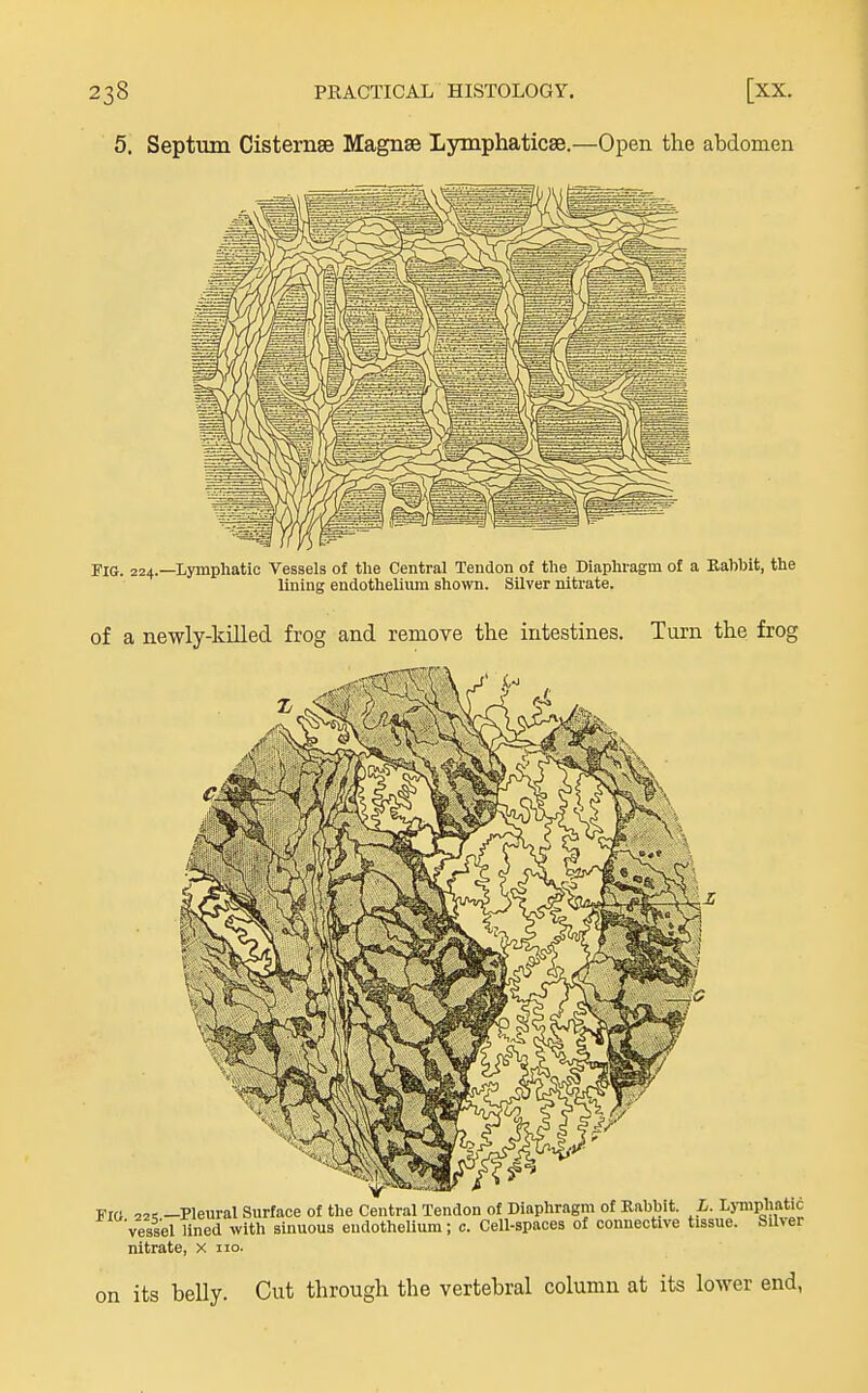 5. Septum Cisternse Magnse Lymphaticse.—Open the abdomen Fig. 224.—Lymphatic Vessels of the Central Tendon of the Diaphragm of a Rahhifc, the lining endothelium shown. Silver nitrate. of a newly-killed frog and remove the intestines. Turn the frog FIO 22^ -Pleural Surface of the Central Tendon of Diaphragm of Rabbit. L. Lj-niphatic vessel lined with sinuous endothelium; c. Cell-spaces of connective tissue. Siher nitrate, x no. on its belly. Cut through the vertebral column at its lower end,