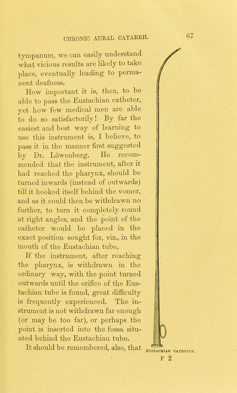 fi7 tympanum, we can easily understand what vicious results are likely to take place, eventually leading to perma- nent deafness. How important it is, then, to be able to pass the Eustachian catheter, yet how few medical men are able to do so satisfactorily! By far the easiest and best way of learning to use this instrument is, I believe, to pass it in the manner first suggested by Dr. Lowenberg. He recom- mended that the instrument, after it had reached the pharynx, should be turned inwards (instead of outwards) till it hooked itself behind the vomer, and as it could then be withdrawn no further, to turn it completely round at right angles, and the point of the catheter would be placed in the exact position sought for, viz., in the mouth of the Eustachian tube. If the instrument, after reaching the pharynx, is withdrawn in the ordinary way, with the point turned outwards until the orifice of the Eus- tachian tube is found, great difficulty is frequently experienced. The in- strument is not withdrawn far enough (or may be too far), or perhaps the point is inserted into the fossa situ- ated behind the Eustachian tube. It should be remembered, also, that EOSTACHIAN CATHKTKH. p 2