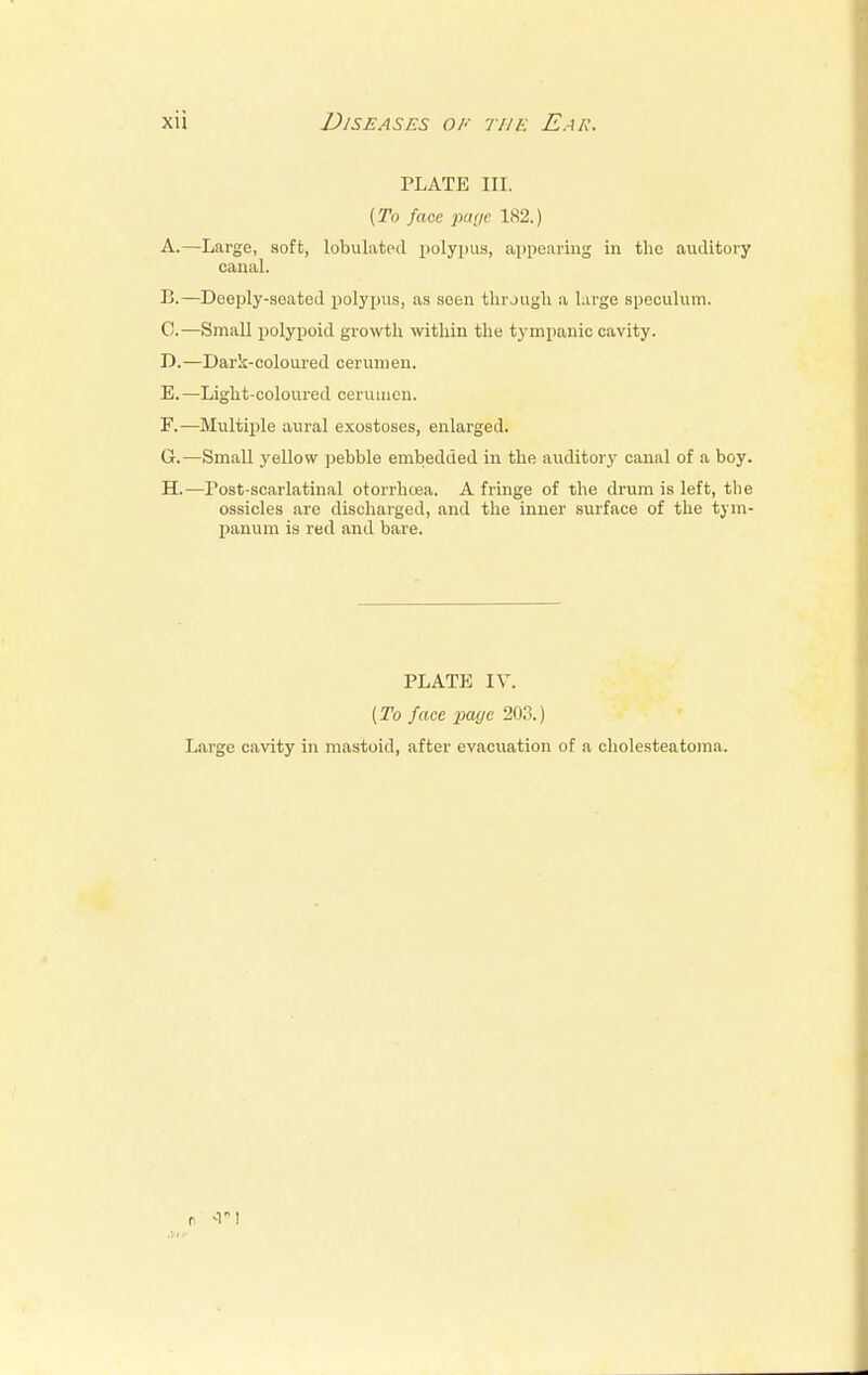 PLATE ill. (To face par/c 182.) A.—Large, soft, tabulated polypus, appearing in the auditory canal. E.—Deeply-seated polypus, as seen through a lai-ge speculum. C. —Small polypoid growth within the tympanic cavity. D. —Dark-coloured cerumen. E. —Light-coloured cerumen. F. —Multiple aural exostoses, enlarged. G. —Small yellow pebble embedded in the auditory canal of a boy. H. —Post-scarlatinal otorrhoea. A fringe of the drum is left, the ossicles are discharged, and the inner surface of the tym- panum is red and bare. PLATE IV. (To face page 203.) Large cavity in mastoid, after evacuation of a cholesteatoma.