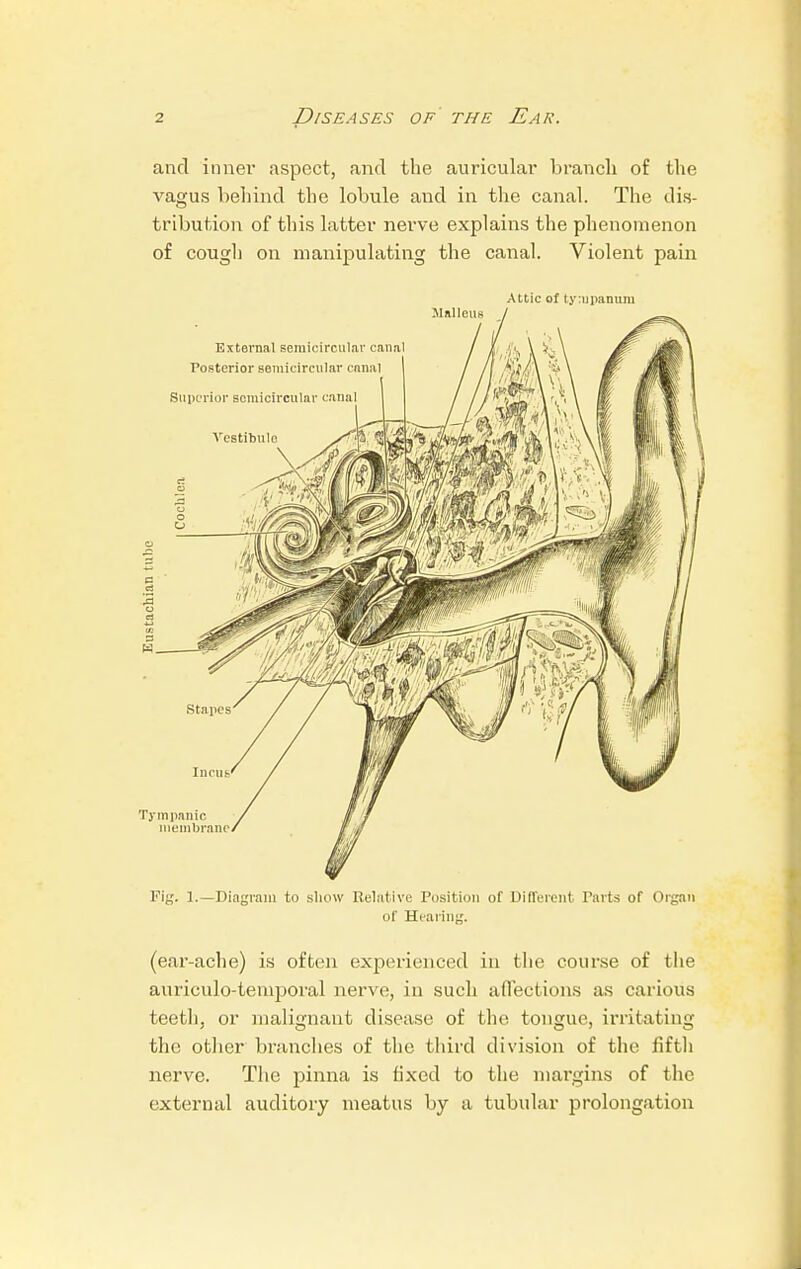 and inner aspect, and the auricular branch of the vagus behind the lobule and in the canal. The dis- tribution of this latter nerve explains the phenomenon of cough on manipulating the canal. Violent pain Attic of tympanum Fig. 1.—Diagram to show Relative Position of Different Tarts of Organ of Heai ing. (ear-ache) is often experienced in the course of the auriculo-tenrporal nerve, in such affections as carious teeth, or malignant disease of the tongue, irritating the other branches of the third division of the fifth nerve. The pinna is fixed to the margins of the external auditory meatus by a tubular prolongation