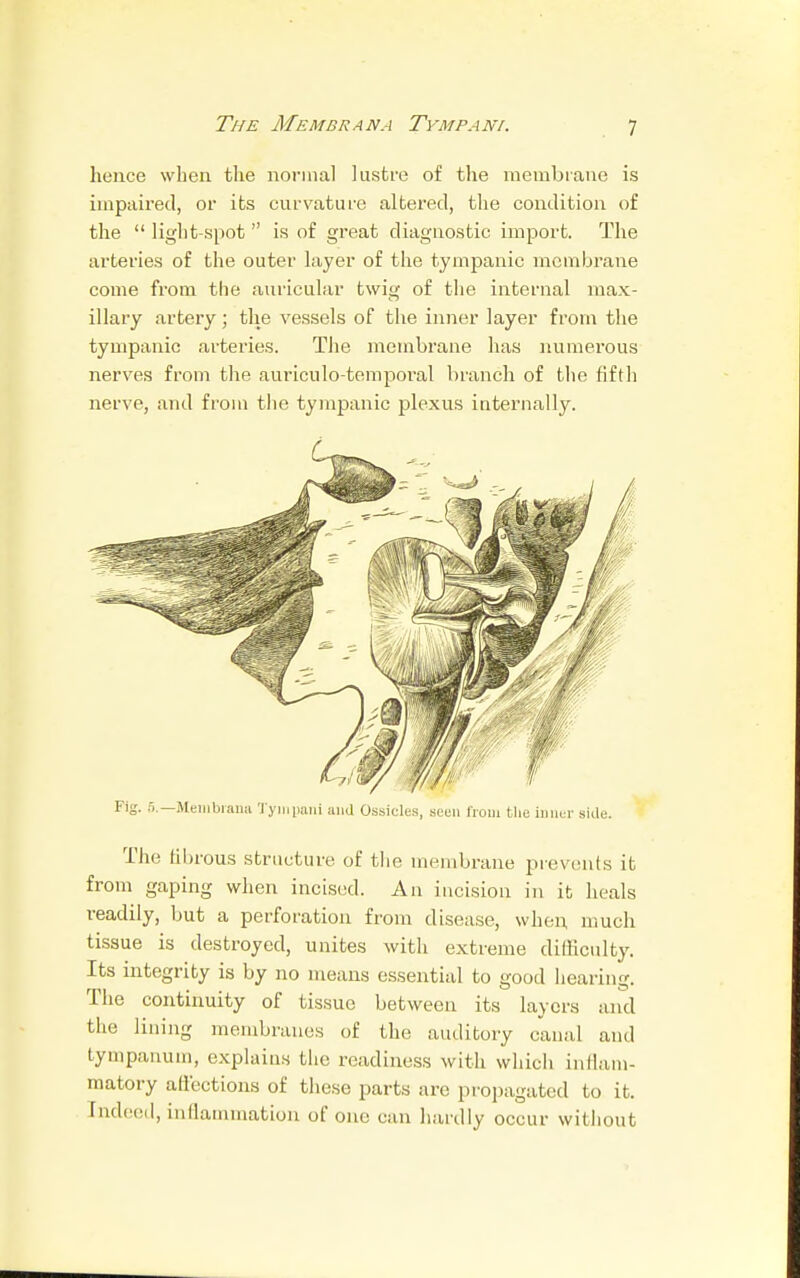 hence when the normal lustre of the membrane is impaired, or its curvature altered, the condition of the  light-spot is of great diagnostic import. The arteries of the outer layer of the tympanic membrane come from the auricular twig of the internal max- illary artery; the vessels of the inner layer from the tympanic arteries. The membrane has numerous nerves from the auriculo-temporal branch of the fifth nerve, and from the tympanic plexus internally. Fig. 5.—Membrana Tympani and Ossicles, seen from the inner side. The fibrous structure of the membrane prevents it from gaping when incised. An incision in it heals readily, but a perforation from disease, when much tissue is destroyed, unites with extreme difficulty. Its integrity is by no means essential to good hearing. The continuity of tissue between its layers and the lining membranes of the auditory canal and tympanum, explains the readiness with which inflam- matory affections of these parts are propagated to it. Indeed, inflammation of one can hardly occur without