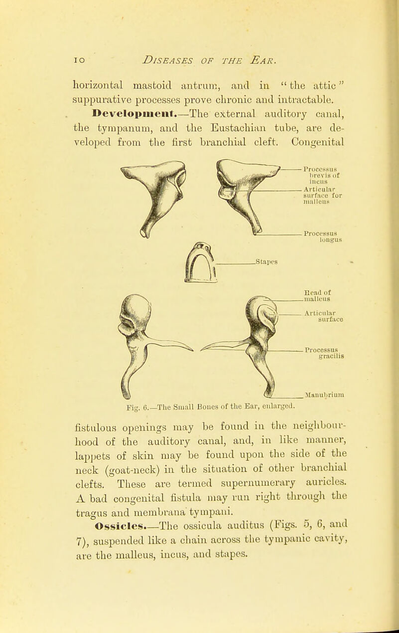 horizontal mastoid antrum, and in  the attic suppurative processes prove chronic and intractable. Development.—The external auditory canal, the tympanum, and the Eustachian tube, are de- veloped from the first branchial cleft. Congenital Processus hrevis of incus Articular surface for malleus Processus lougus Head of .malleus Articular surface Processus gracilis Manubrium Fig. e.—The Small Bones of the Bar, enlarged. fistulous openings may be found in the neighbour- hood of the auditory canal, and, in like manner, lappets of skin may be found upon the side of the neck (goat-neck) in the situation of other branchial clefts. These are termed supernumerary auricles. A bad congenital fistula may run right through the tragus and membrana tympani. Ossicles.—The ossicula auditus (Figs. 5, 6, and 7), suspended like a chain across the tympanic cavity, are the malleus, incus, and stapes.