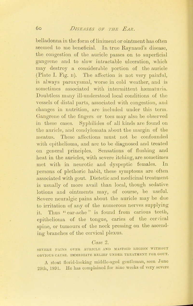 belladonna in the form of liniment or ointment has often seemed to me beneficial. In true Raynaud's disease, the congestion of the auricle passes on to superficial gangrene and to slow intractable ulceration, which may destroy a considerable portion of the auricle (Plate I. Fig. 13). The affection is not very painful, is always paroxysmal, worse in cold weather, and is sometimes associated with intermittent hematuria. Doubtless many ill-understood local conditions of the vessels of distal parts, associated with congestion, and changes in nutrition, are included under this term. Gangrene of the fingers or toes may also be observed in these cases. Syphilides of all kinds are found on the auricle, and condylomata about the margin of the meatus. These affections must not be confounded with epithelioma, and are to be diagnosed and treated on general principles. Sensations of flushing and heat in the auricles, with severe itching, are sometimes met with in neurotic and dyspeptic females. In persons of plethoric habit, these symptoms are often associated with gout. Dietetic and medicinal treatment is usually of more avail than local, though sedative lotions and ointments may, of course, be useful. Severe neuralgic pains about the auricle may be due to irritation of any of the numerous nerves supplying it. Thus  ear-ache is found from carious teeth, epithelioma of the tongue, caries of the cervical spine, or tumours of the neck pressing on the ascend- ing branches of the cervical plexus. Case 2. SEVERE PAINS OVER AURICLE AND MASTOID REGION WITHOUT OBVIOUS CAUSE. IMMEDIATE RELIEF UNDER TREATMENT FOR GOUT. A stout florid-looking middlo-aged gentleman, Been Juno 29th, 1891. lie has complained for nine weeks of very severe