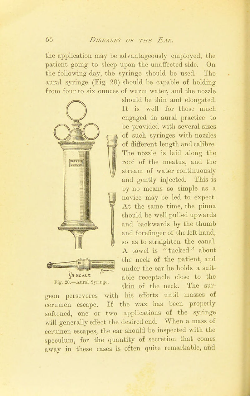 the application may be advantageously employed, the patient going to sleep upon the unaffected side. On the following day, the syringe should be used. The aural syringe (Fig. 20) should be capable of holding from four to six ounces of warm water, and the nozzle should be thin and elongated. It is well for those much engaged in aural practice to be provided with several sizes of such syringes with nozzles of different length and calibre. The nozzle is laid along the roof of the meatus, and the stream of water continuously and gently injected. This is by no means so simple as a novice may be led to expect. At the same time, the pinna should be well pulled upwards and backwai'ds by the thumb and forefinger of the left hand, so as to straighten the canal. A towel is  tucked  about the neck of the patient, and under the ear he holds a suit- able receptacle close to the skin of the neck. The sur- his efforts until masses of the wax has been properly I/3 SCALE 20.—Aural Syringe. geon perseveres with cerumen escape. If softened, one or two applications of the syringe will generally effect the desired end. When a mass of cerumen escapes, the ear should be inspected with the speculum, for the quantity of secretion that comes away in these cases is often quite remarkable, and