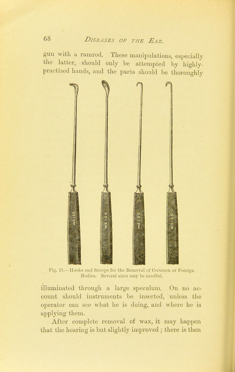 gun with a ramrod. These manipulations, especially the latter, should only be attempted by highly- practised hands, and the parts should be thoroughly Fig. 21.—Hooks and Scoops for the Removal of Cerumen or Foreign Bodies. Several sizes may be needful. illuminated through a large speculum. On no ac- count should instruments be inserted, unless the operator can see what he is doing, and where he is applying them. After complete removal of wax, it may happen that the hearing is but slightly improved ; there is then