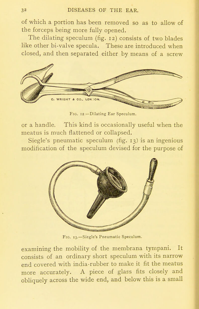 of which a portion has been removed so as to allow of the forceps being more fully opened. The dilating speculum (fig. 12) consists of two blades like other bi-valve specula. These are introduced when closed, and then separated either by means of a screw Fig. 12 —Dilating Ear Speculum. or a handle. This kind is occasionally useful when the meatus is much flattened or collapsed. Siegle's pneumatic speculum (fig. 13) is an ingenious modification of the speculum devised for the purpose of Fig. 13.—Siegle's Pneumatic Speculum. examining the mobility of the membrana tyrnpani. It consists of an ordinary short speculum with its narrow end covered with india-rubber to make it fit the meatus more accurately. A piece of glass fits closely and obliquely across the wide end, and below this is a small