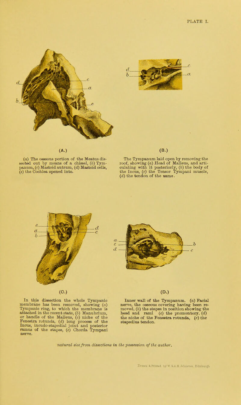 (A.) (a) The osseous portion of the Meatus dis- sected out by means of a chissel, (b) Tym- panum, (c) Mastoid antrum, (d) Mastoid ceUa, (c) the Cochlea opened into. (B.) The Tympanum laid open by removing the roof, showing (a) Head of Malleus, and arti- culating with it posteriorly, (6) the body of the Incus, (c) the Tensor Tympani muscle, (<<) the tendon of the same. (C.) In this dissection the whole Tympanic membrane has been removed, showing (a) Tympanic ring, to which the membrane is attached in the recent state, (b) Manubrium, or handle of the Malleus, (c) niohe of the Fenestra rotunda, (d) long process of the Incus, incudo-stapedial joint and posterior ramus of the stapes, (e) Chorda Tympani nerve. (D.) Inner wall of the Tympanum, (a) Facial nerve, the osseous covering having been re- moved. (6) the stapes in position showing the head and rami (c) the promontory, (d) the niche of the Fenestra rotunda, (<•) the stapedius tendon. natural sue from dissections in the possession of the author. Drawn St Printe.1 I17 W VA.K Jnhn»tnn EilinVurgli