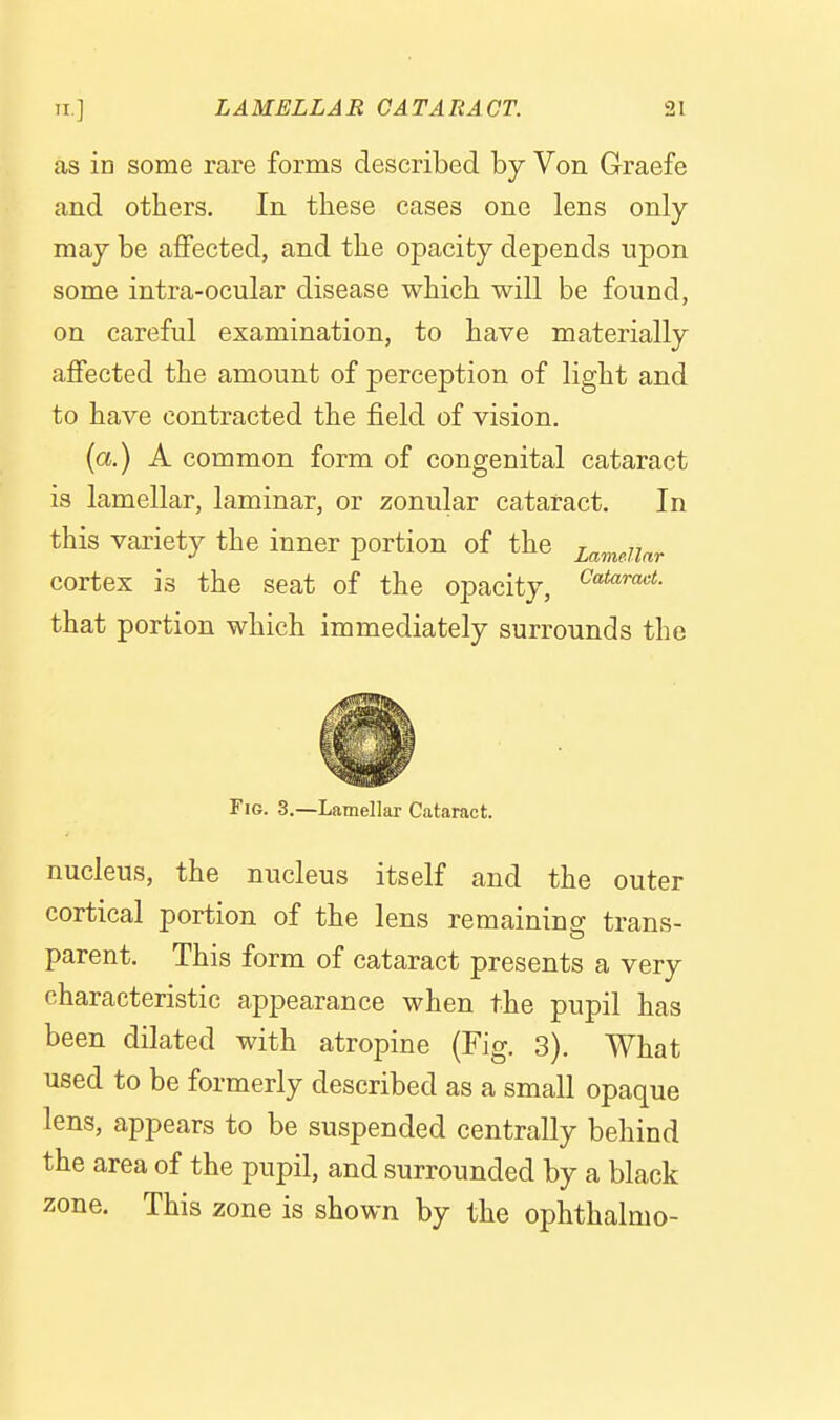 as in some rare forms described by Von Graefe and others. In these eases one lens only may be aflfected, and the opacity depends upon some intra-ocular disease which will be found, on careful examination, to have materially affected the amount of perception of light and to have contracted the field of vision. (a.) A common form of congenital cataract is lamellar, laminar, or zonular cataract. In this variety the inner portion of the zamaiar cortex is the seat of the opacity, that portion which immediately surrounds the Fig. 3.—Lamellar Cataract. nucleus, the nucleus itself and the outer cortical portion of the lens remaining trans- parent. This form of cataract presents a very characteristic appearance when the pupil has been dilated with atropine (Fig. 3). What used to be formerly described as a small opaque lens, appears to be suspended centrally behind the area of the pupil, and surrounded by a black zone. This zone is shown by the ophthalmo-
