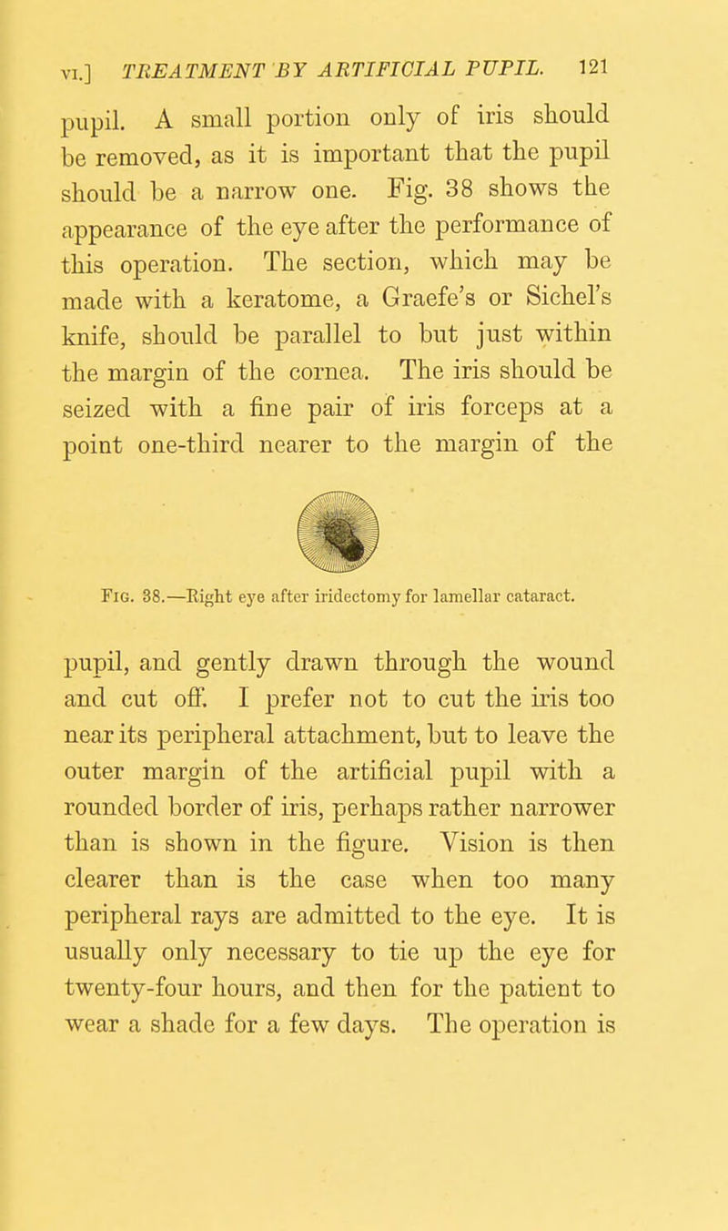 pupil. A small portion only of iris should be removed, as it is important that the pupil should be a narrow one. Fig. 38 shows the appearance of the eye after the performance of this operation. The section, which may be made with a keratome, a Graefe's or Sichel's knife, should be parallel to but just within the margin of the cornea. The iris should be seized with a fine pair of iris forceps at a point one-third nearer to the margin of the Fig. 38.—Eight eye after iridectomy for lamellar cataract. pupil, and gently drawn through the wound and cut oflp. I prefer not to cut the iris too near its peripheral attachment, but to leave the outer margin of the artificial pupil with a rounded border of iris, perhaps rather narrower than is shown in the figure. Vision is then clearer than is the case when too many peripheral rays are admitted to the eye. It is usually only necessary to tie up the eye for twenty-four hours, and then for the patient to wear a shade for a few days. The operation is