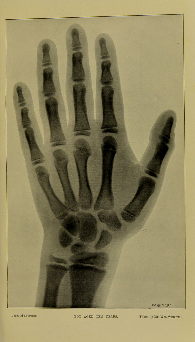 1 sccoud exposure. BOY AGED TEN YEAKS. Taken by Mr. Wm. Webstkr.