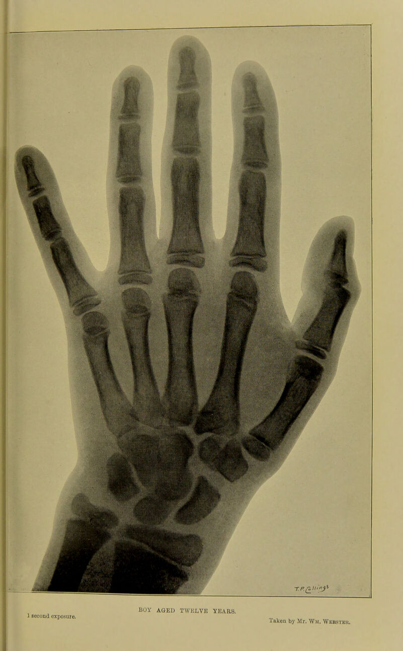 1 second exposure. BOY AGED TWELVE YEARS. Taken by Jlr. Wii. Wkbstkk.