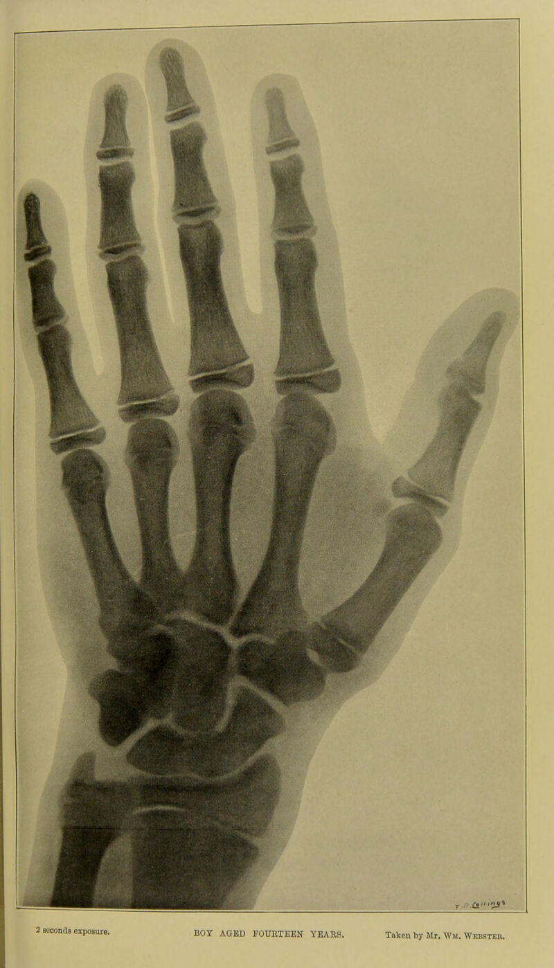 2 seconda oxposure. BOY AGED FOURTEEN YEARS. Taken by Mr. Wm. Webster,