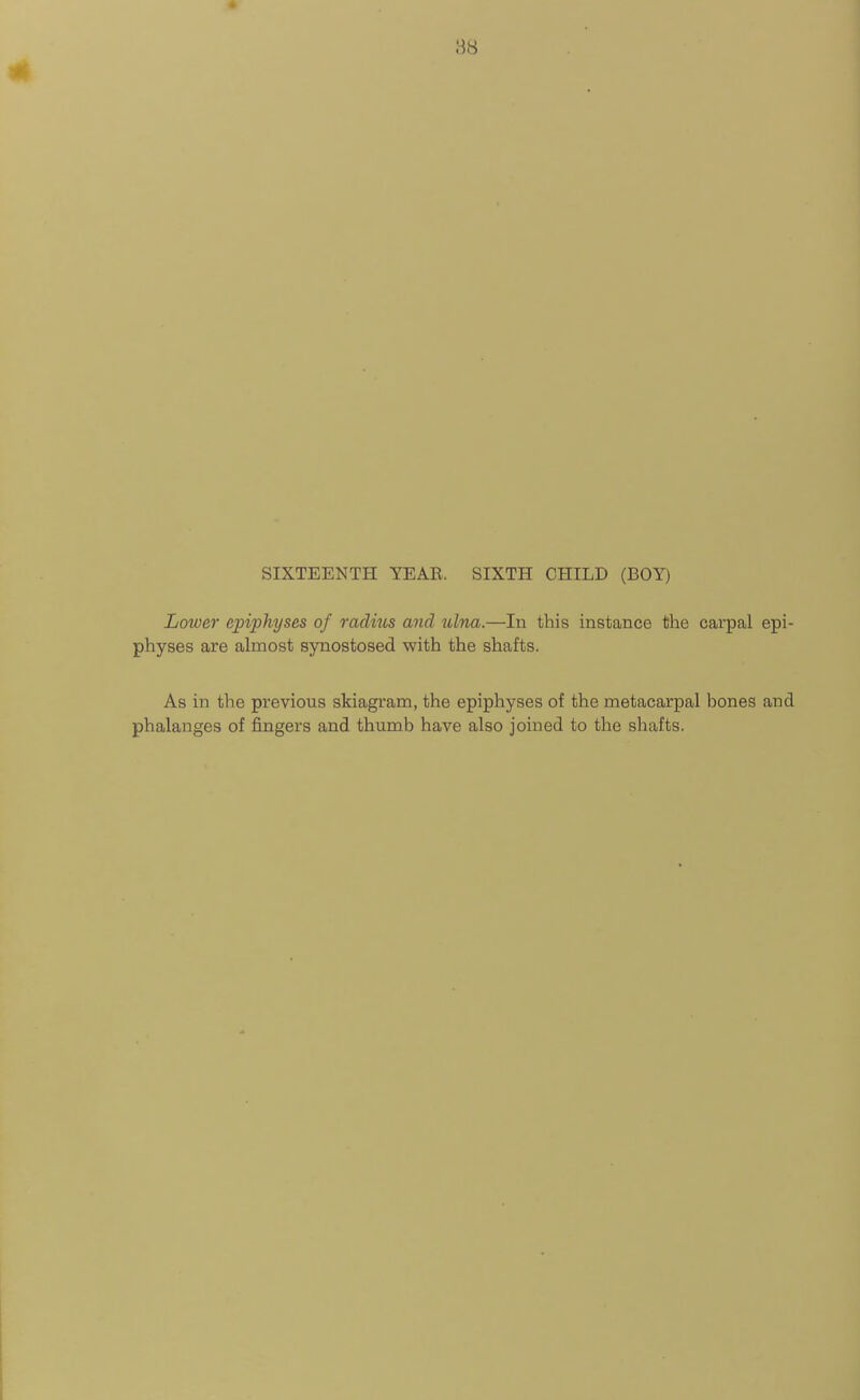H8 SIXTEENTH YEAB. SIXTH CHILD (BOY) Loioer epiphyses of radius and ulna.—In this instance the carpal epi- physes are almost synostosed with the shafts. As in the previous skiagram, the epiphyses of the metacarpal bones and phalanges of fingers and thumb have also joined to the shafts.