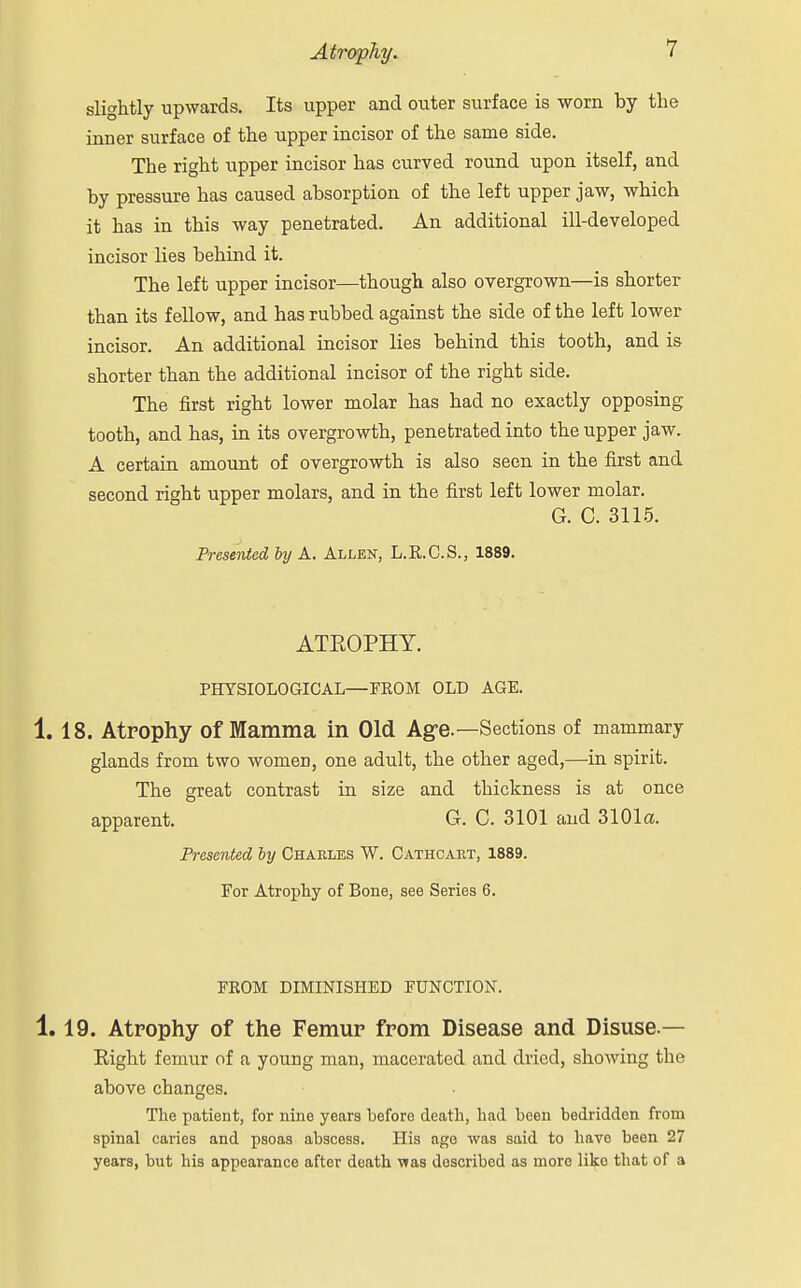 slightly upwards. Its upper and outer surface is worn by the inner surface of the upper incisor of the same side. The right upper incisor has curved round upon itself, and by pressure has caused absorption of the left upper jaw, which it has in this way penetrated. An additional ill-developed incisor lies behind it. The left upper incisor—though also overgrown—is shorter than its fellow, and has rubbed against the side of the left lower incisor. An additional incisor lies behind this tooth, and is shorter than the additional incisor of the right side. The first right lower molar has had no exactly opposing tooth, and has, in its overgrowth, penetrated into the upper jaw. A certain amount of overgrowth is also seen in the first and second right upper molars, and in the first left lower molar. G. C. 3115. Presented by A. Allen, L.R.C.S., 1889. ATROPHY. PHYSIOLOGICAL—FROM OLD AGE. 1. 18. Atrophy Of Mamma in Old Age.—Sections of mammary glands from two women, one adult, the other aged,—in spirit. The great contrast in size and thickness is at once apparent. G. C. 3101 and 3101a. Presented by Charles W. Cathcart, 1889. For Atrophy of Bone, see Series 6. FKOM DIMINISHED FUNCTION. 1.19. Atrophy of the Femur from Disease and Disuse.— Right femur of a young man, macerated and dried, showing the above changes. The patient, for nine years before death, had been bedridden from spinal caries and psoas abscess. His age was said to have been 27 years, but his appearance after death was described as more like that of a