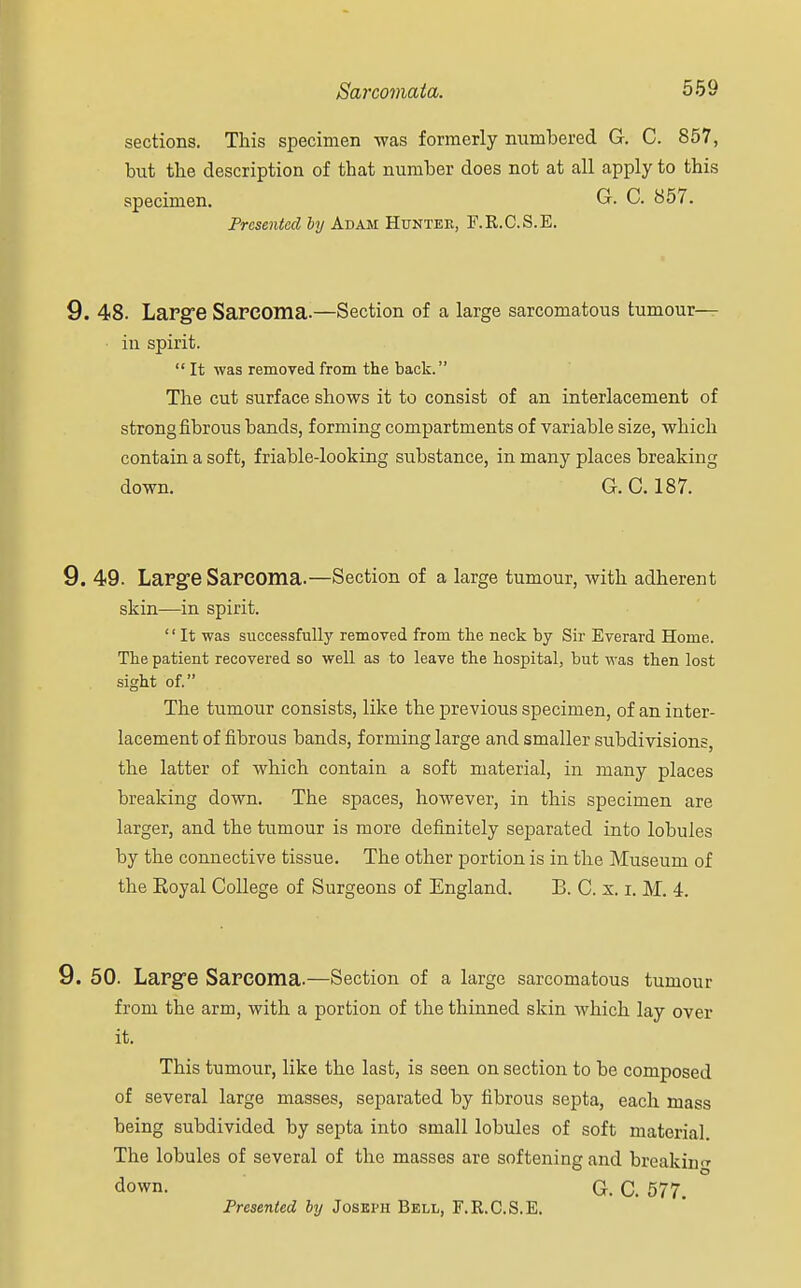 sections. This specimen was formerly numbered G. C. 857, but the description of that number does not at all apply to this specimen. G. C. 857. Presented by Adam Hunter, F.R.C.S.E. 9. 48. Large Sarcoma.—Section of a large sarcomatous tumour— in spirit.  It was removed from the back. The cut surface shows it to consist of an interlacement of strong fibrous bands, forming compartments of variable size, which contain a soft, friable-looking substance, in many places breaking down. G. C. 187. 9. 49. Large Sarcoma.—Section of a large tumour, with adherent skin—in spirit. '1 It was successfully removed from the neck by Sir Everard Home. The patient recovered so well as to leave the hospital, but was then lost sight of. The tumour consists, like the previous specimen, of an inter- lacement of fibrous bands, forming large and smaller subdivisions, the latter of which contain a soft material, in many places breaking down. The spaces, however, in this specimen are larger, and the tumour is more definitely separated into lobules by the connective tissue. The other portion is in the Museum of the Eoyal College of Surgeons of England. B. C. s. i. M. 4. 9. 50. Large Sarcoma.—Section of a large sarcomatous tumour from the arm, with a portion of the thinned skin which lay over it. This tumour, like the last, is seen on section to be composed of several large masses, separated by fibrous septa, each mass being subdivided by septa into small lobules of soft material. The lobules of several of the masses are softening and breaking down. G. C. 577. Presented by Joseph Bell, F.R.C.S.E.