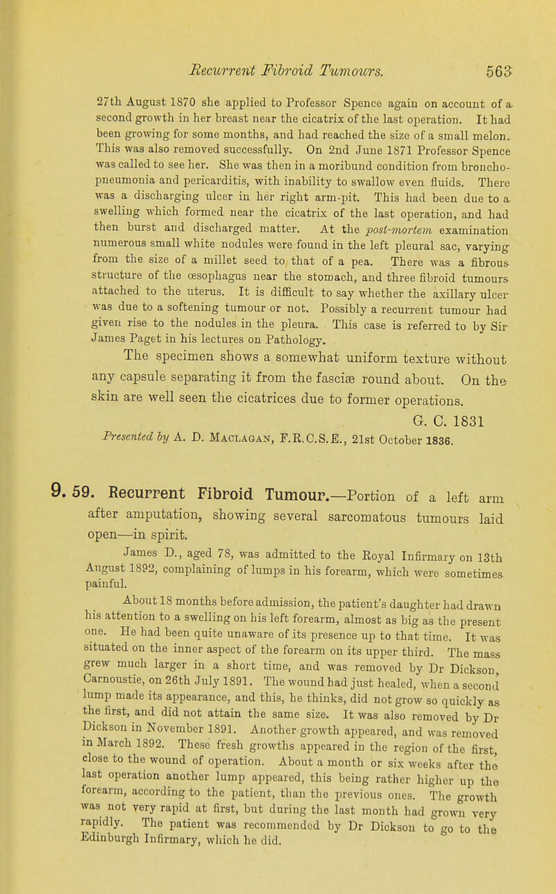 27th August 1870 she .applied to Professor Spence again on account of a second growth in her breast near the cicatrix of the last operation. It had been growing for some months, and had reached the size of a small melon. This was also removed successfully. On 2nd June 1871 Professor Spence was called to see her. She was then in a moribund condition from broncho- pneumonia and pericarditis, with inability to swallow even fluids. There was a discharging ulcer in her right arm-pit. This had been due to a. swelling which formed near the cicatrix of the last operation, and had then burst and discharged matter. At the post-mortem examination numerous small white nodules were found in the left pleural sac, varying from the size of a millet seed to that of a pea. There was a fibrous structure of the oesophagus near the stomach, and three fibroid tumours attached to the uterus. It is difficult to say whether the axillary ulcer was due to a softening tumour or not. Possibly a recurrent tumour had given rise to the nodules in the pleura. This case is referred to by Sir James Paget in his lectures on Pathology. The specimen shows a somewhat uniform texture without any capsule separating it from the fascia? round about. On the skin are well seen the cicatrices due to former operations G. C. 1831 Presented by A. D. Maclagan, F.R.C.S.E., 21st October 1836. 59. Recurrent Fibroid Tumour.—Portion of a left arm after amputation, showing several sarcomatous tumours laid open—in spirit. James D., aged 78, was admitted to the Royal Infirmary on 13th August 1892, complaining of lumps in his forearm, which were sometimes painful. About 18 months before admission, the patient's daughter had drawn his attention to a swelling on his left forearm, almost as big as the present one. He had been quite unaware of its presence up to that time. It was situated on the inner aspect of the forearm on its upper third. The mass grew much larger in a short time, and was removed by Dr Dickson Carnoustie, on 26th July 1891. The wound had just healed, when a second lump made its appearance, and this, he thinks, did not grow so quickly as the first, and did not attain the same size. It was also removed by Dr Dickson in November 1891. Another growth appeared, and was removed m March 1892. These fresh growths appeared in the region of the first, close to the wound of operation. About a month or six weeks after the last operation another lump appeared, this being rather higher up the forearm, according to the patient, than the previous ones. The growtli was not very rapid at first, but during the last month had grown very rapidly. The patient was recommended by Dr Dickson to go to the Edinburgh Infirmary, which he did.