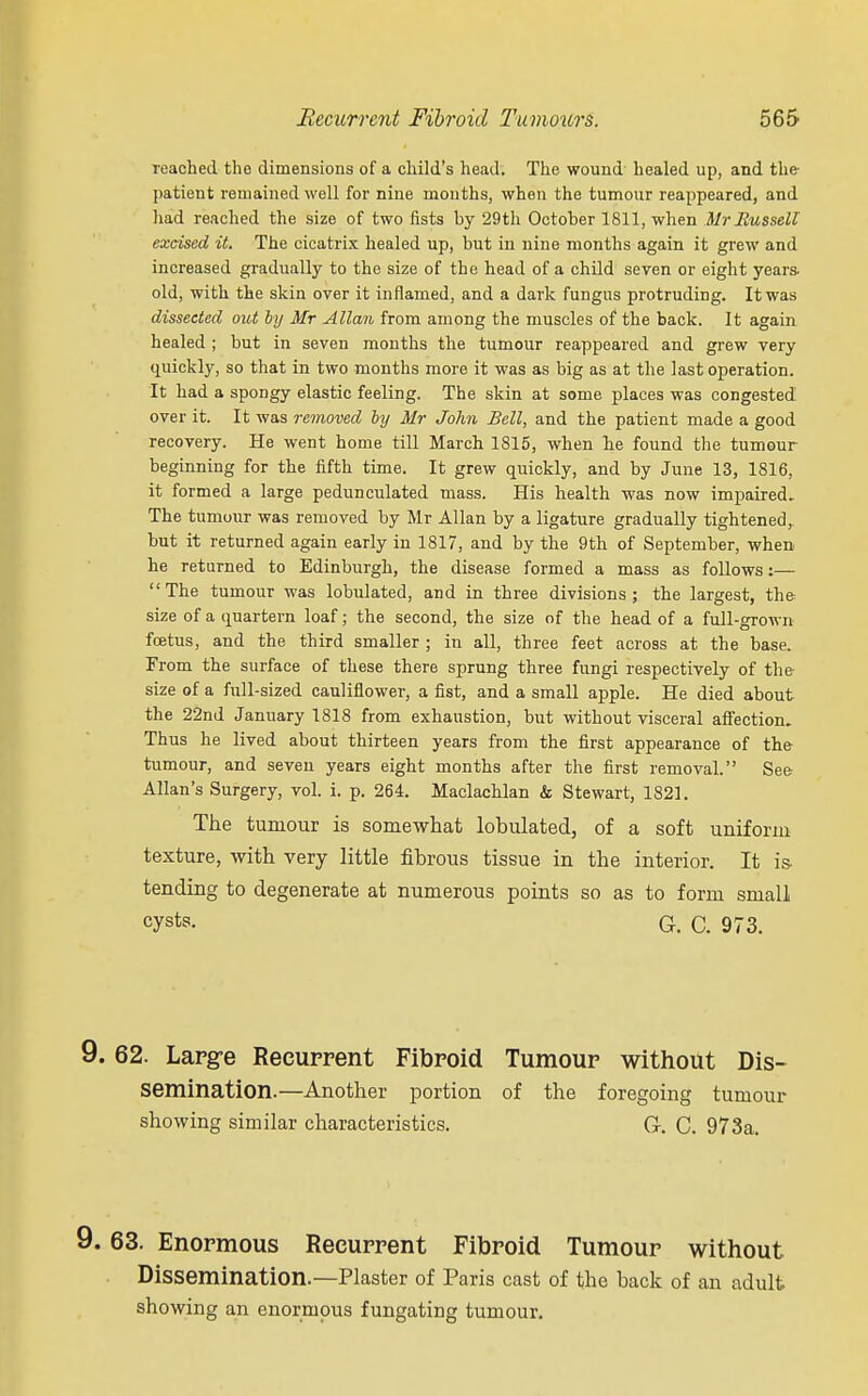 leached the dimensions of a child's head. The wound healed up, and the- patient remained well for nine months, when the tumour reappeared, and had reached the size of two fists by 29th October 1811, when Mr Russell excised it. The cicatrix healed up, but in nine months again it grew and increased gradually to the size of the head of a child seven or eight years old, with the skin over it inflamed, and a dark fungus protruding. It was dissected out by Mr Allan from among the muscles of the back. It again healed ; but in seven months the tumour reappeared and grew very quickly, so that in two months more it was as big as at the last operation. It had a spongy elastic feeling. The skin at some places was congested over it. It was removed by Mr John Bell, and the patient made a good recovery. He went home till March 1815, when he found the tumour beginning for the fifth time. It grew quickly, and by June 13, 1816, it formed a large pedunculated mass. His health was now impaired. The tumour was removed by Mr Allan by a ligature gradually tightened, but it returned again early in 1817, and by the 9th of September, when he returned to Edinburgh, the disease formed a mass as follows:— The tumour was lobulated, and in three divisions; the largest, the size of a quartern loaf; the second, the size of the head of a full-grown foetus, and the third smaller ; in all, three feet across at the base. From the surface of these there sprung three fungi respectively of the size of a full-sized cauliflower, a fist, and a small apple. He died about the 22nd January 1818 from exhaustion, but without visceral affection. Thus he lived about thirteen years from the first appearance of the tumour, and seven years eight months after the first removal. See Allan's Surgery, vol. i. p. 264. Maclachlan & Stewart, 1821. The tumour is somewhat lobulated, of a soft uniform texture, with very little fibrous tissue in the interior. It is- tending to degenerate at numerous points so as to form small cysts- G. C. 973. 9. 62. Large Recurrent Fibroid Tumour without Dis- semination.—Another portion of the foregoing tumour showing similar characteristics. G. C. 973a. 9. 63. Enormous Recurrent Fibroid Tumour without Dissemination.—Plaster of Paris cast of the back of an adult showing an enormous fungating tumour.