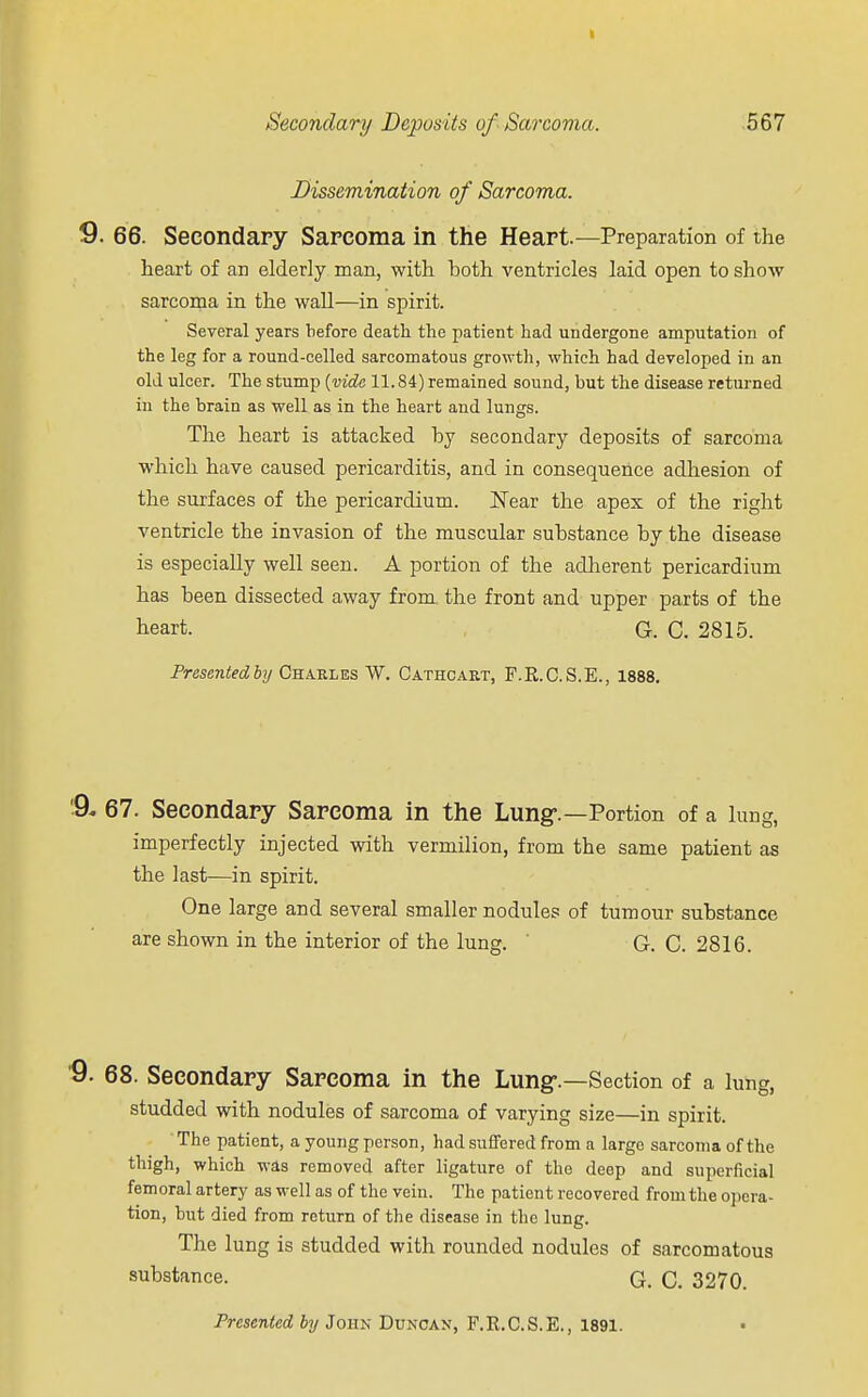 Dissemination of Sarcoma. 66. Secondary Sarcoma in the Heart.—Preparation of the heart of an elderly man, with both ventricles laid open to show sarcoma in the wall—in spirit. Several years before death the patient had undergone amputation of the leg for a round-celled sarcomatous growth, which had developed in an old ulcer. The stump {vide 11.84) remained sound, but the disease returned in the brain as well as in the heart and lungs. The heart is attacked by secondary deposits of sarcoma which have caused pericarditis, and in consequence adhesion of the surfaces of the pericardium. Near the apex of the right ventricle the invasion of the muscular substance by the disease is especially well seen. A portion of the adherent pericardium has been dissected away from the front and upper parts of the beart. G. C. 2815. Presented by Charles W. Cathcart, F.E.C.S.E., 1888. 67. Secondary Sarcoma in the Lung-.—Portion of a lung, imperfectly injected with vermilion, from the same patient as the last—in spirit. One large and several smaller nodules of tumour substance are shown in the interior of the lung. G. C. 2816. 68. Secondary Sarcoma in the Lung-.—Section of a lung, studded with nodules of sarcoma of varying size—in spirit. The patient, a young person, had suffered from a large sarcoma of the thigh, which was removed after ligature of the deep and superficial femoral artery as well as of the vein. The patient recovered from the opera- tion, but died from return of the disease in the lung. The lung is studded with rounded nodules of sarcomatous substance. G. C. 3270. Presented by John Duncan, F.R.C.S.E., 1891.