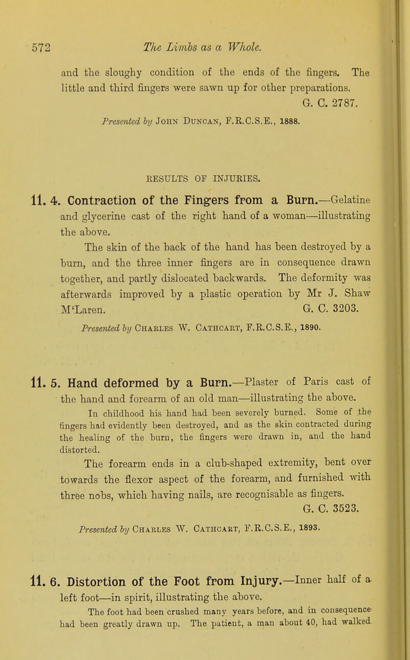 and the sloughy condition of the ends of the fingers. The little and third fingers were sawn up for other preparations. G. C. 2787. Presented by John Duncan, F.R.C.S.E., 1888. EESULTS OF INJURIES. 11. 4. Contraction of the Fingers from a Burn.—Gelatine and glycerine cast of the right hand of a woman—illustrating the above. The skin of the hack of the hand has been destroyed by a burn, and the three inner fingers are in consequence drawn together, and partly dislocated backwards. The deformity was afterwards improved by a plastic operation by Mr J. Shaw M'Laren. G. C. 3203. Presented by Charles W. Cathcart, F.R.C.S.E., 1890. 11. 5. Hand deformed by a Burn.—Plaster of Paris cast of • the hand and forearm of an old man—illustrating the above. In childhood his hand had been severely burned. Some of the fingers had evidently been destroyed, and as the skin contracted during the healing of the burn, the fingers were drawn in, and the hand distorted. The forearm ends in a club-shaped extremity, bent over towards the flexor aspect of the forearm, and furnished with three nobs, which having nails, are recognisable as fingers. G. C. 3523. Presented by Charles W. Cathcart, F.R.C.S.E., 1893. 11. 6. Distortion of the Foot from Injury.—Inner half of a left foot—in spirit, illustrating the above. The foot had been crushed many years before, and in consequence had been greatly drawn up. The patient, a man about 40, had walked