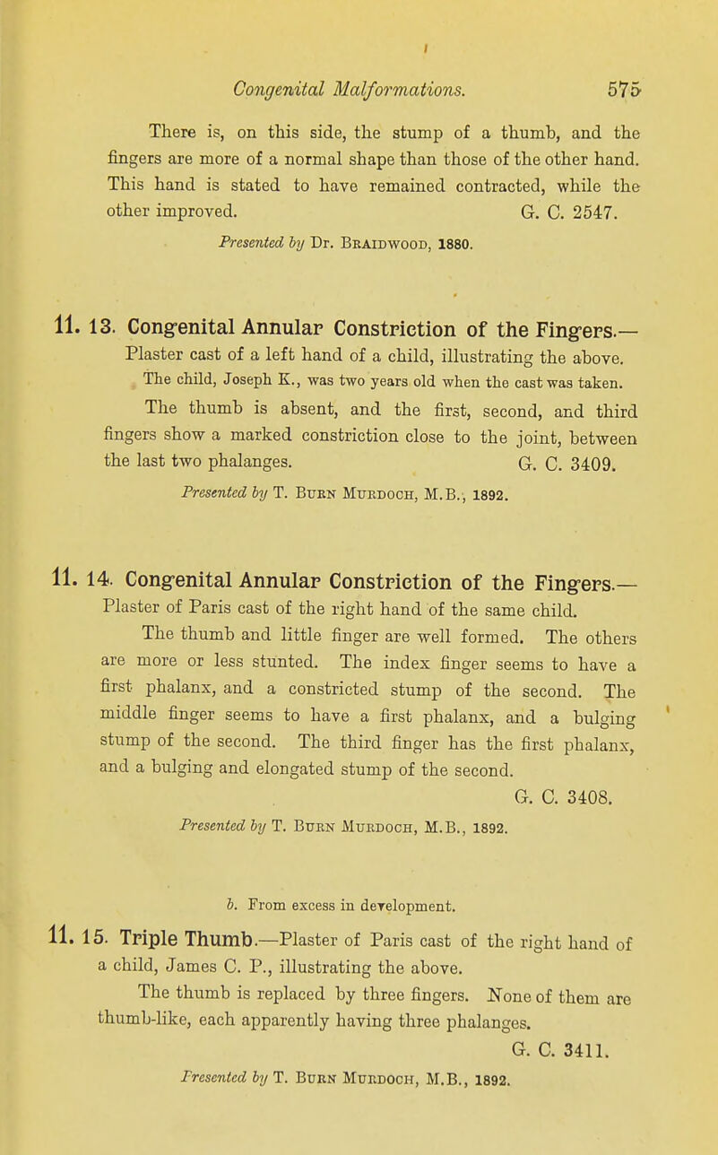 There is, on this side, the stump of a thumb, and the fingers are more of a normal shape than those of the other hand. This hand is stated to have remained contracted, while the other improved. G. C. 2547. Presented by Dr. Bkaidwood, 1880. 13. Congenital Annular Constriction of the Fingers.— Plaster cast of a left hand of a child, illustrating the above. The child, Joseph K., was two years old when the cast was taken. The thumb is absent, and the first, second, and third fingers show a marked constriction close to the joint, between the last two phalanges. G. C. 3409. Presented by T. Burn Mukdoch, M.B., 1892. 14. Congenital Annular Constriction of the Fingers.— Plaster of Paris cast of the right hand of the same child. The thumb and little finger are well formed. The others are more or less stunted. The index finger seems to have a first phalanx, and a constricted stump of the second. The middle finger seems to have a first phalanx, and a bulging stump of the second. The third finger has the first phalanx, and a bulging and elongated stump of the second. G. C. 3408. Presented by T. Burn Murdoch, M.B., 1892. b. From excess in derelopment. 15. Triple Thumb.—Plaster of Paris cast of the right hand of a child, James C. P., illustrating the above. The thumb is replaced by three fingers. None of them are thumb-like, each apparently having three phalanges. G. C. 3411. Presented by T. Burn Murdoch, M.B., 1892.