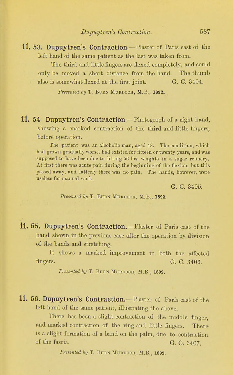 11. 53. Dupuytren's Contraction.—Plaster of Paris cast of the left hand of the same patient as the last was taken from. The third and little fingers are flexed completely, and could only be moved a short distance from the hand. The thumb also is somewhat flexed at the first joint. G. C. 3404. Presented by T. Burn Murdoch, M.B., 1892. 11. 54. Dupuytren's Contraction.—Photograph of a right hand, showing a marked contraction of the third and little fingers, before operation. The patient was an alcoholic man, aged 48. The condition, which had grown gradually worse, had existed for fifteen or twenty years, and was supposed to have been due to lilting 56 lbs. weights in a sugar refinery. At first there was acute pain during the beginning of the flexion, but this passed away, and latterly there was no pain. The hands, however, were useless for manual work. G. C. 3405. Presented by T. Burn Murdoch, M.B., 1892. 11. 55. Dupuytren's Contraction.—Plaster of Paris cast of the hand shown in the previous case after the operation by division of the bands and stretching. It shows a marked improvement in both the affected fingers. G. C. 3406. Presented by T. Burn Murdoch, M.B., 1892. 11. 56. Dupuytren's Contraction.—Plaster of Paris cast of the left hand of the same patient, illustrating the above. There has been a slight contraction of the middle finger, and marked contraction of the ring and little fingers. There is a slight formation of a band on the palm, due to contraction of the fascia. G. C. 3407.