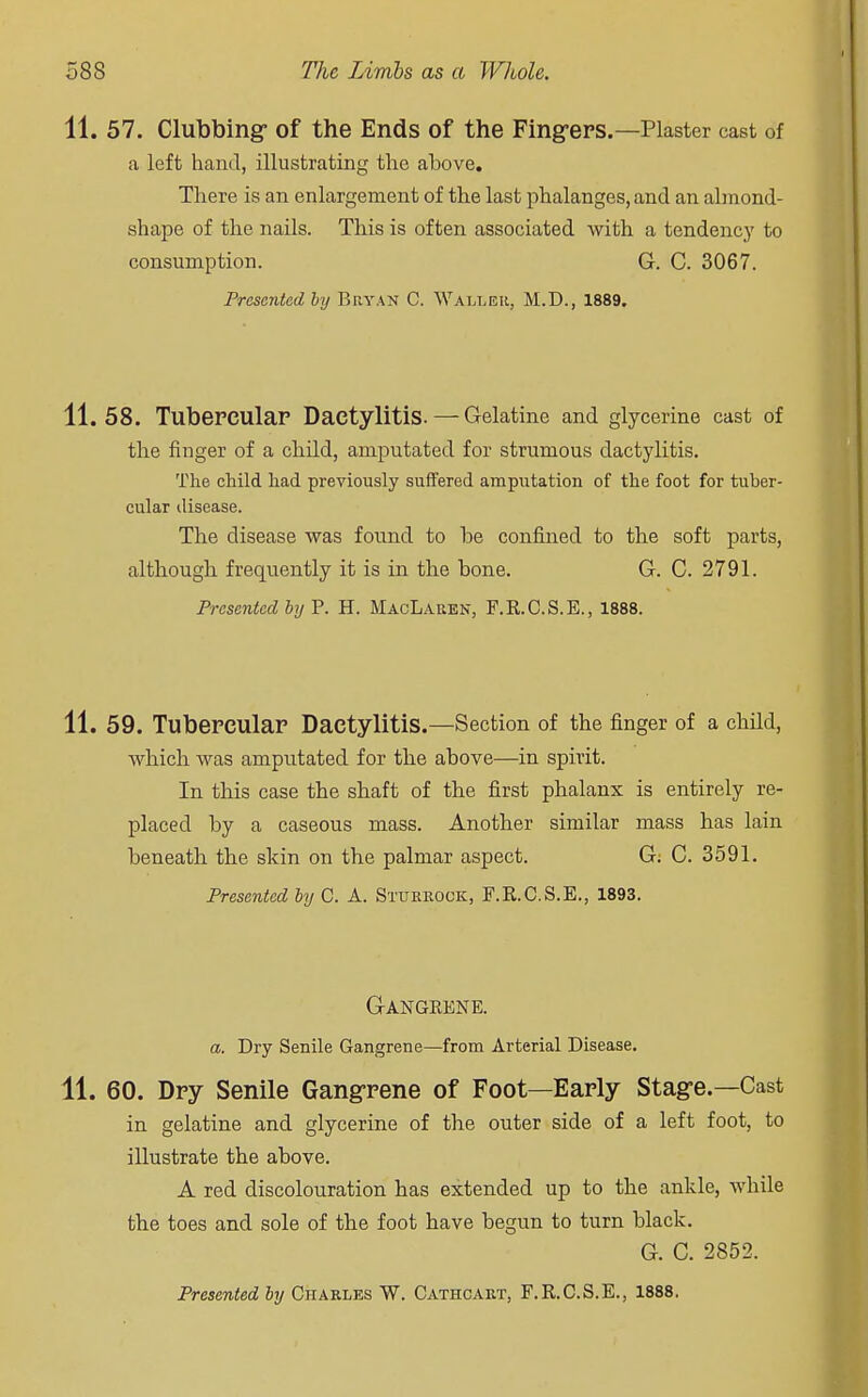 11. 57. Clubbing- of the Ends of the Fingers.—Plaster cast of a left hand, illustrating the ahove. There is an enlargement of the last phalanges, and an almond- si iape of the nails. This is often associated Avith a tendency to consumption. G. C. 3067. Presented by Bryan C. Waller, M.D., 1889. 11.58. Tubercular Dactylitis. — Gelatine and glycerine cast of the finger of a child, amputated for strumous dactylitis. The child had previously suffered amputation of the foot for tuber- cular disease. The disease was found to be confined to the soft parts, although frequently it is in the bone. G. C. 2791. Presented by P. H. MacLauen, F.R.C.S.E., 1888. 11. 59. Tubercular Dactylitis.—Section of the finger of a chdd, Avhich was amputated for the above—in spirit. In this case the shaft of the first phalanx is entirely re- placed by a caseous mass. Another similar mass has lain beneath the skin on the palmar aspect. G. C. 3591. Presented by C. A. Sturrock, F.R.C.S.E., 1893. G-ANGEENE. a. Dry Senile Gangrene—from Arterial Disease. 11. 60. Dry Senile Gangrene of Foot—Early Stage.—Cast in gelatine and glycerine of the outer side of a left foot, to illustrate the above. A red discolouration has extended up to the ankle, while the toes and sole of the foot have begun to turn black. G. C. 2852. Presented by Charles W. Cathcart, F.R.C.S.E., 1888.