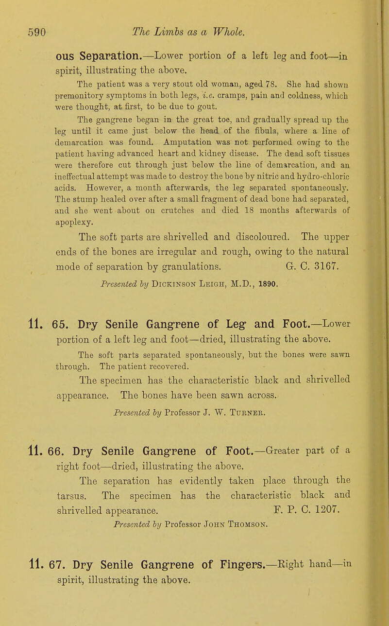 OUS Separation.—Lower portion of a left leg and foot—in spirit, illustrating the above. The patient was a very stout old woman, aged 78. She had shown premonitory symptoms in both legs, i.e. cramps, pain and coldness, which were thought, at first, to be due to gout. The gangrene began in the great toe, and gradually spread up the leg until it came just below the head of the fibula, where a line of demarcation was found. Amputation was not performed owing to the patient having advanced heart and kidney disease. The dead soft tissues were therefore cut through just below the line of demarcation, and an ineffectual attempt was made to destroy the bone by nitric and hydro-chloric acids. However, a month afterwards, the leg separated spontaneously. The stump healed over after a small fragment of dead bone had separated, and she went about on crutches and died 18 months afterwards of apoplexy. The soft parts are shrivelled and discoloured. The upper ends of the bones are irregular and rough, owing to the natural mode of separation by granulations. G. C. 3167. Presented by Dickinson Leigh, M.D., 1890. 11. 65. Dry Senile Gangrene of Leg and Foot.—Lower portion of a left leg and foot—dried, illustrating the above. The soft parts separated spontaneously, but the bones were sawn through. The patient recovered. The specimen has the characteristic black and shrivelled appearance. The bones have been sawn across. Presented by Professor J. W. Tubner. 11. 66. Dry Senile Gangrene of Foot.—Greater part of a right foot—dried, illustrating the above. The separation has evidently taken place through the tarsus. The specimen has the characteristic black and shrivelled appearance. F. P. C. 1207. Presented by Professor John Thomson. 11. 67. Dry Senile Gangrene of Fing-ers.—Right hand—in spirit, illustrating the above.