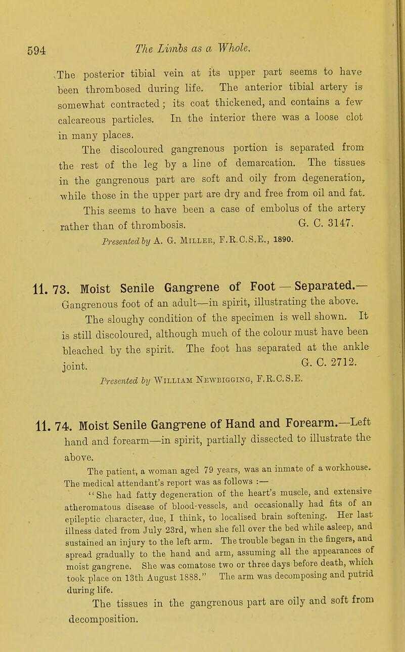 The posterior tibial vein at its upper part seems to have been thrombosed during life. The anterior tibial artery is somewhat contracted; its coat thickened, and contains a few calcareous particles. In the interior there was a loose clot in many places. The discoloured gangrenous portion is separated from the rest of the leg by a line of demarcation. The tissues in the gangrenous part are soft and oily from degeneration, while those in the upper part are dry and free from oil and fat. This seems to have been a case of embolus of the artery rather than of thrombosis. Gr. C. 3147. Presented by A. G. Miller, F.K.C.S.E., 1890. 11. 73. Moist Senile Gangrene of Foot — Separated.— Gangrenous foot of an adult—in spirit, illustrating the above. The sloughy condition of the specimen is well shown. It is still discoloured, although much of the colour must have been bleached by the spirit. The foot has separated at the ankle joint. G- C- 2712> Presented by William Newbigging, F.R.C.S.E. 11. 74. Moist Senile Gangrene of Hand and Forearm.—Left hand and forearm—in spirit, partially dissected to illustrate the above. The patient, a woman aged 79 years, was an inmate of a workhouse. The medical attendant's report was as follows :— She had fatty degeneration of the heart's muscle, and extensive atheromatous disease of blood-vessels, and occasionally had fits of an epileptic character, due, I think, to localised brain softening. Her last illness dated from July 23rd, when she fell over the bed while asleep, and sustained an injury to the left arm. The trouble began in the fingers, and spread gradually to the hand and arm, assuming all the appearances of moist gangrene. She was comatose two or three days before death, which took place on 13th August 1888. The arm was decomposing and putrid during life. The tissues in the gangrenous part are oily and soft from decomposition.