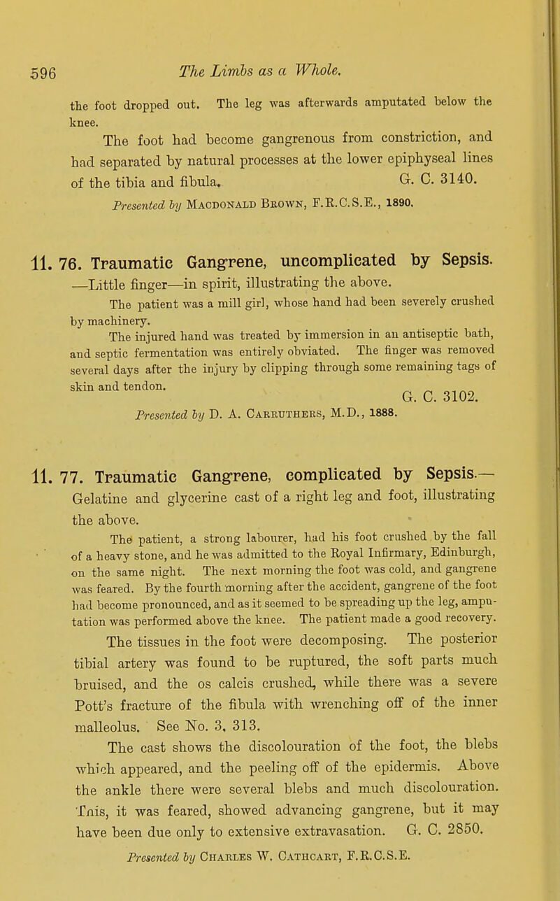 the foot dropped out. The leg was afterwards amputated below the knee. The foot had become gangrenous from constriction, and had separated by natural processes at the lower epiphyseal lines of the tibia and fibula. G. C. 3140. Presented by Macdonald Brown, F.E.C.S.E., 1890. 11. 76. Traumatic Gangrene, uncomplicated by Sepsis. —Little finger—in spirit, illustrating the above. The patient was a mill girl, whose hand had been severely crushed by machinery. The injured hand was treated by immersion in an antiseptic bath, and septic fermentation was entirely obviated. The finger was removed several days after the injury by clipping through some remaining tags of skin and tendon. Q c< nQ2 Presented by D. A. Carrtjthers, M.D., 1888. 11. 77. Traumatic Gangrene, complicated by Sepsis.— Gelatine and glycerine cast of a right leg and foot, illustrating the above. The patient, a strong labourer, had his foot crushed by the fall of a heavy stone, and he was admitted to the Royal Infirmary, Edinburgh, on the same night. The next morning the foot was cold, and gangrene was feared. By the fourth morning after the accident, gangrene of the foot had become pronounced, and as it seemed to be spreading up the leg, ampu- tation was performed above the knee. The patient made a good recovery. The tissues in the foot were decomposing. The posterior tibial artery was found to be ruptured, the soft parts much bruised, and the os calcis crushed, while there was a severe Pott's fracture of the fibula with wrenching off of the inner malleolus. See No. 3, 313. The cast shows the discolouration of the foot, the blebs which appeared, and the peeling off of the epidermis. Above the ankle there were several blebs and much discolouration. Tnis, it was feared, showed advancing gangrene, but it may have been due only to extensive extravasation. G. C. 2850. Presented by Charles W. Cathcart, F.R.C.S.E.