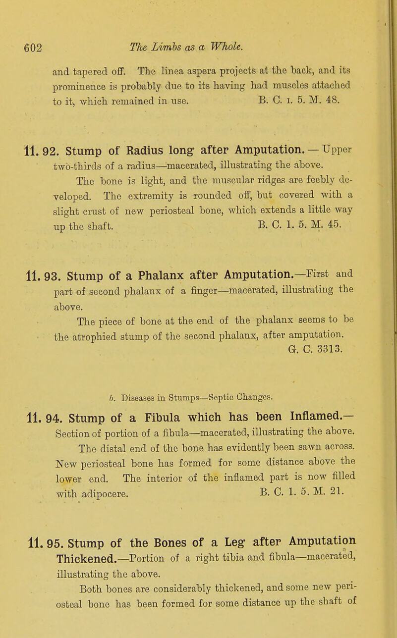 and tapered off. The linea aspera projects at the back, and its prominence is probably due to its having had muscles attached to it, which remained in use. B. C. i. 5. M. 48. 11. 92. Stump of Radius long after Amputation. — Upper two-thirds of a radius—macerated, illustrating the above. The bone is light, and the muscular ridges are feebly de- veloped. The extremity is rounded off, but covered with a slight crust of new periosteal bone, which extends a little way up the shaft. B. C. 1. 5. M. 45. 11. 93. Stump of a Phalanx after Amputation.—First and part of second phalanx of a finger—macerated, illustrating the above. The piece of bone at the end of the phalanx seems to be the atrophied stump of the second phalanx, after amputation. G. C. 3313. b. Diseases in Stumps—Septic Changes. 11. 94. Stump of a Fibula which has been Inflamed.— Section of portion of a fibula—macerated, illustrating the above. The distal end of the bone has evidently been sawn across. New periosteal bone has formed for some distance above the lower end. The interior of the inflamed part is now filled with adipocere. B. C. 1. 5. M. 21. 11. 95. Stump of the Bones of a Leg after Amputation Thickened.—Portion of a right tibia and fibula—macerated, illustrating the above. Both bones are considerably thickened, and some new peri- osteal bone has been formed for some distance up the shaft of