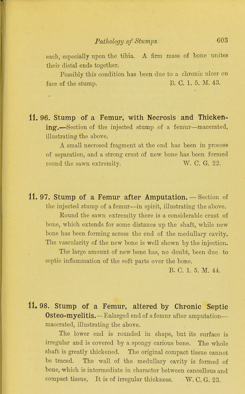 each, especially upon the tibia. A firm mass of bone unites their distal ends together. Possibly this condition has been due to a chronic ulcer on face of the stump. B. C. 1. 5. M. 43. 11. 96. Stump of a Femup, with Necrosis and Thicken- ing.—Section of the injected stump of a femur—macerated, illustrating the above. A small necrosed fragment at the end has been in process of separation, and a strong crust of new bone has been formed round the sawn extremity. W. C. G. 22. 11. 97. Stump of a Femur after Amputation. — Section of the injected stump of a femur—in spirit, illustrating the above. Eound the sawn extremity there is a considerable crust of bone, which extends for some distance up the shaft, while new bone has been forming across the end of the medullary cavity. The vascularity of the new bone is well shown by the injection. The large amount of new bone has, no doubt, been due to septic inflammation of the soft parts over the bone. B. C. 1. 5. M. 44. 11.98. Stump of a Femur, altered by Chronic Septic Osteo-myelitis.—Enlarged end of a femur after amputation— macerated, illustrating the above. The lower end is rounded in shape, but its surface is irregular and is covered by a spongy carious bone. The whole shaft is greatly thickened. The original compact tissue cannot be traced. The wall of the medullary cavity is formed of bone, which is intermediate in character between cancellous and compact tissue. It is of irregular thickness. W. C. G. 23.