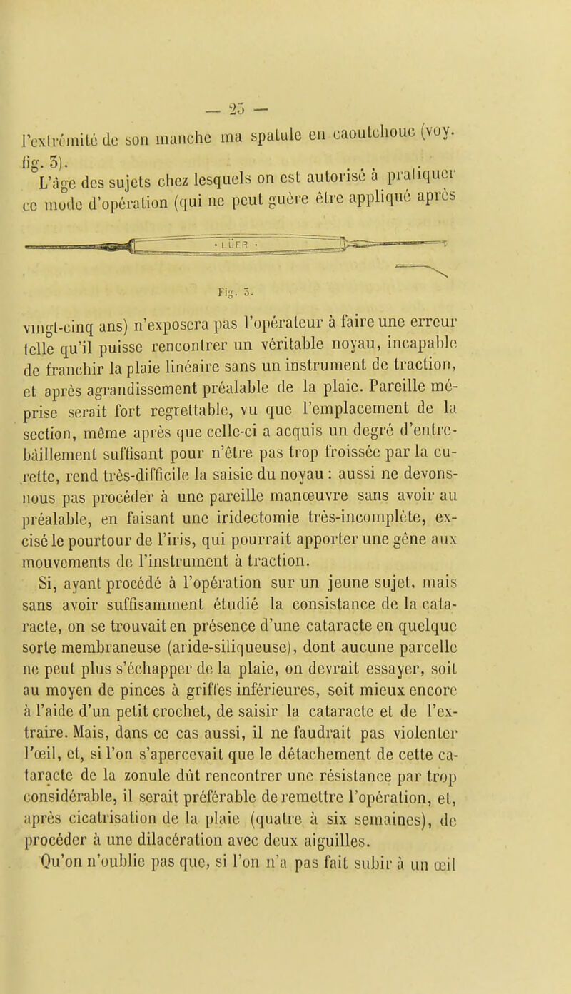 IV'xIrcinilede son inaiiche ma spaLule en caouLcliouc (voy. lig. 5). L'agc dcs sujets chcz lesquels on est autoiise a praliqucr CO niodo d'opcralion (qui iic pcuL gucre clre applique aprcs LbER Fii;. o. vHigl-cinq ans) n'exposera pas I'operaleur a faire unc errcur Iclle qu'il puissc renconlrer un veritable noyau, incapable de franchir la plaie lineaire sans un instrument de traction, ct apres agrandissement prealable de la plaie. Pareille me- prise serait fort regrettable, vu que I'emplacement de la section, meme apres que celle-ci a acquis un degrc d'entrc- baillement suffisant pour n'etre pas trop froissee par la cu- rette, rend tres-difficile la saisie du noyau : aussi ne devons- iious pas proceder a une pareille manoeuvre sans avoir au prealable, en faisant une iridectomie tres-incomplete, ex- cise le pourtour de I'iris, qui pourrait apporter une gene aiix mouvements de i'instrument a traction. Si, ayanl precede a I'operation sur un jeune sujel, rnais sans avoir suffisamment etudie la consistance de la cata- racte, on se trouvait en presence d'une cataracte en quclquc sorte membraneuse (aride-siliqueuse), dont aucune parcelle nc peut plus s'echapper de la plaie, on devrait essayer, soil au moyen de pinces a grifl'es inferieures, soit mieux encore a I'aide d'un petit crochet, de saisir la cataracte et de I'ex- traire. Mais, dans ce cas aussi, il ne faudrait pas violenter I'oeil, et, si Ton s'apercevail que le detachement de cette ca- laracte de la zonule diit rencontrer une resistance par trop considerable, il serait preferable deremettre I'operalion, et, apres cicatrisation de la plaie (qualre a six semaines), de proceder a une dilac6ration avec deux aiguilles. Qu'on n'oublic pas que, si Ton n'a pas fait subir a un ceil
