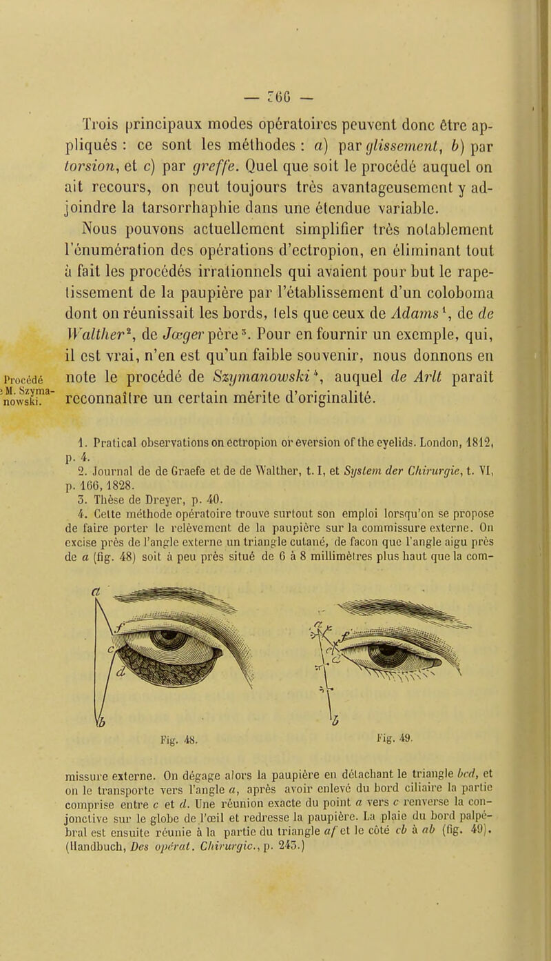 Trois principaux modes op6ratoircs pcuvcnt done 6tre ap- pliques : ce sonl les melhodcs : a) \)Sir glissemenl, 6) par torsion, et c) par greffe. Quel que soil le proc6de auqucl on ait rccours, on pent toujours trcs avantageuscmcnt y ad- joindre la tarsorrhaphie dans une 6lcndue variable. Nous pouvons acluellement simplifier Ires nolablcment rcnumcralion dos operations d'ectropion, en eliminant tout a fait les procedes irralionnels qui avaient pour but le rape- lissement de la paupiere par I'etablissemcnt d'un coloboma dont on reunissait les bords, I els que ceux de Adamsde de Walther^, de Jo-f/er pcre^. Pour enfournir un exemple, qui, il est vrai, n'en est qu'un faible souvenir, nous donnons en Procede Hotc le procedc de Szijmanowski *, auquel de Arlt parait nowski!''' rcconnaiire un certain merile d'originalite. 1. Pratical observations on ectropion or eversion of the eyelids. London, 1812, p. 4. 2. Journal de de Graefe et de de Walther, 1.1, et System der Cliirurgie, t. VI, p. m, 1828. 0. These de Dreyer, p. 40. 4. CeUe inethode operatoire trouve surtout son emploi lorsqu'on se propose de faire porter le rclevemcnt de la paupiere sur la commissure esterne. On excise pros de Tanfrlc exlerne un triangle culane, de facon que Tangle aigu pres de a (fig. 48) soit a peu pres situ6 de 6 a 8 miUim6lres plus haut que la com- missure eiterne. On degage alors la paupiere en dclacliant le triangle bed, et on le transportc vers I'angle a, apres avoir enlevc du bord ciliaire la partic comprise entre c et d. Une reunion exacte du point a vers c rcnverse la con- jonclive sur le globe de.l'oiil et redi^esse la paupiere. La plaie du bord palpe- bral est ensuite reunie a la partic du triangle a/ ct le cote cb a ab (lig. 49). (Ilandbuch, Dcs opcral. C/iirurgic, p. 245.)