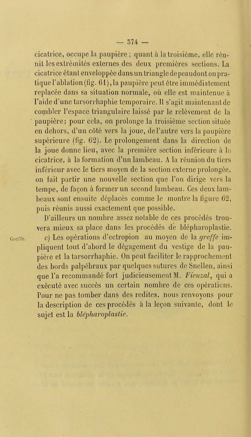 cicatrice, occupc la paupiere; quanl a la Iroisicme, cllc reu- nit lesexlreinites exlemes des deux premieres sections. La cicatrice 6tanl enveloppee dans un triangle de peaudont on pra- tique I'ablation (fig. 61), la paupiere pcut 6tre immediatement replacee dans sa situation normale, oil elle est mainlenuc a I'aide d'unc tarsorrhaphie temporairc. 11 s'agit maintenantde cornbler I'ebpace triangulaire laiss6 par le relevement de la ■ paupiere; pour ccla, on prolonge la troisieme section situee en dehors, d'un c6te vers la joue, del'autre vers la paupiere superieure (fig. 62). Le prolongement dans la direction de la joue donne lieu, avec la premiere section inf6rieure a hi cicatrice, a la formation d'un lambeau. A la reunion du tiers inferieur avec le tiers moyen de la section externe prolongee, on fait partir une nouvelle section que Ton dirige vers la tempe, de fag.on a former un second lambeau. Ces deux lam- beaux sont ensuitc deplaces comme le montre la figure 6'2, puis r6unis aussi exactement que possible. D'ailleurs un nombre assez notable de ces precedes trou- vera mieux sa place dans les precedes de blepharoplastie. cicrie. c) Les operations d'ectropion au moyen de la greffe im- pliquent tout d'abord le d6gagement du veslige de la pau- piere et la tarsorrhaphie. On pent faciliter le rapprochement des bords palp6braux par quelques sutures de Snellen, ainsi que I'a recommande fort judicieusemeiit M. Fieuzal, quia execute avec succes un certain nombre de ces operations. Pour ne pas tomber dans des redites, nous renvoyons pour la description de ces precedes a la legon suivante, dont le sujet est la blepharoplastie.