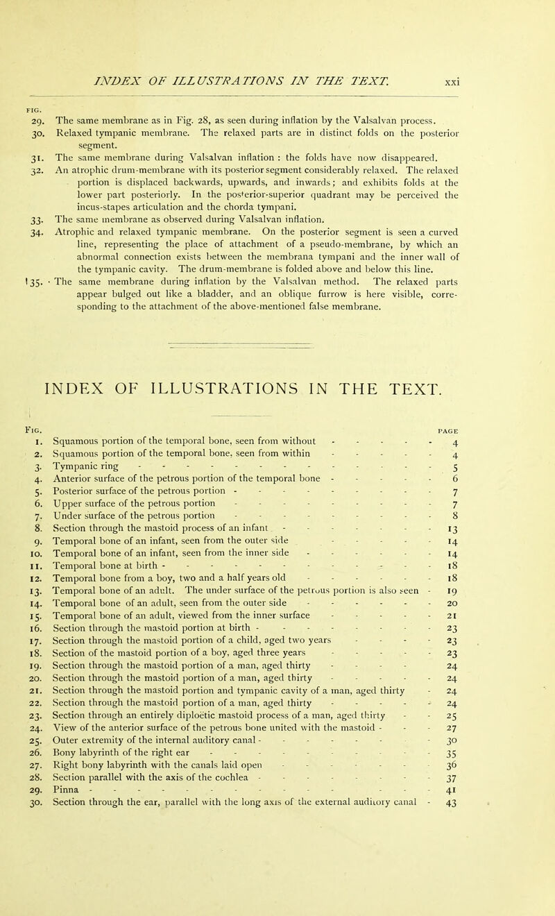 FIG. 29. The same membrane as in Fig. 28, as seen during inflation by the Valsalvan process. 30. Relaxed tympanic membrane. The relaxed parts are in distinct folds on the posterior segment. 31. The same membrane during Valsalvan inflation : the folds have now disappeared. 32. An atrophic drum-membrane with its posterior segment considerably relaxed. The relaxed portion is displaced backwards, upwards, and inwards; and exhibits folds at the lower part posteriorly. In the pos'erior-superior quadrant mav be perceived the incus-stapes articulation and the chorda tympani. 33. The same membrane as observed during Valsalvan inflation. 34. Atrophic and relaxed tympanic membrane. On the posterior segment is seen a curved line, representing the place of attachment of a pseudo-membrane, by which an abnormal connection exists between the membrana tympani and the inner wall of the tympanic cavity. The drum-membrane is folded above and below this line. 135. • The same membrane during inflation by the Valsalvan method. The relaxed parts appear bulged out like a bladder, and an oblique furrow is here visible, corre- sponding to the attachment of the above-mentioned false membrane. INDEX OF ILLUSTRATIONS IN THE TEXT. K]G. PAGE 1. Squamous portion of the temporal bone, seen from without ----- 4 2. Squamous portion of the temporal bone, seen from within ----- 4 3. Tympanic ring - - , - . - - 5 4. Anterior surface of the petrous portion of the temporal bone ----- 6 5. Posterior surface of the petrous portion --------- 7 6. Upper surface of the petrous portion --------- 7 7. Under surface of the petrous portion --------- g 8. Section through the mastoid process of an infant ------- 13 9. Temporal bone of an infant, seen from the outer side - - - - 14 10. Temporal bone of an infant, seen from the inner side ------ 14 11. Temporal bone at birth - - - - - - 18 12. Temporal bone from a boy, two and a half years old ... . - 18 13. Temporal bone of an adult. The under surface of the petrous portion is also seen - 19 14. Temporal bone of an adult, seen from the outer side - 20 15. Temporal bone of an adult, viewed from the inner surface - - - - - 21 16. Section through the mastoid portion at birth - ------- 23 17. Section through the mastoid portion of a child, aged two years - - - - 23 18. Section of the mastoid portion of a boy, aged three years 23 19. Section through the mastoid portion of a man, aged thirty - - 24 20. Section through the mastoid portion of a man, aged thirty ----- 24 21. Section through the mastoid portion and tympanic cavity of a man, aged thirty - 24 22. Section through the mastoid portion of a man, aged thirty 24 23. Section through an entirely diploe'tic mastoid process of a man, aged thirty - - 25 24. View of the anterior surface of the petrous bone united with the mastoid - - - 27 25. Outer extremity of the internal auditory canal ------ - 30 26. Bony labyrinth of the right ear - - - - - - - - - - 35 27. Right bony labyrinth with the canals laid open ------- 36 28. Section parallel with the axis of the cochlea -------- 37 29. Pinna - - - 41 30. Section through the ear, parallel with the long axis of the external auditory canal - 43