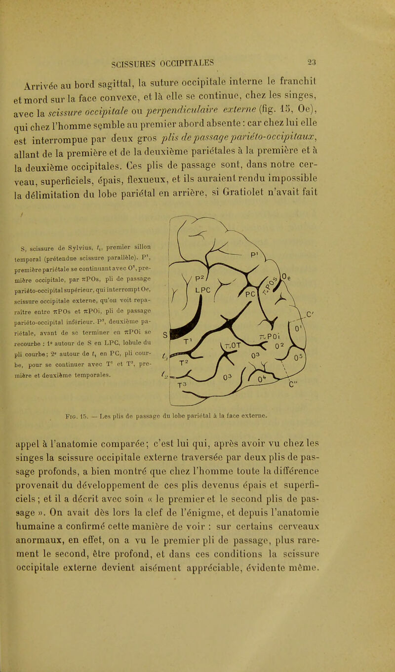 Arrived au bord sagittal, la suture occipitale interne le franchil etmord sur la face convexe, et la clle so continue, chez les singes, avec la scissure occipitale ou perpendiculaire externe (fig. 15, Oe), qui chez l'homme semble au premier abord absente: car chez lui elle est interrompue par deux gros plis de passage paritto-occipitaux, allant de la premiere et de la deuxieme parietales a la premiere et a la deuxieme occipitales. Ces plis de passage sont, clans notre cer- veau, superficiels, dpais, flexueux, et ils auraient rendu impossible la deTimitation da lobe parietal en arriere, si Gratiolet n'avait fait S, scissure de Sylvius, tv premier sillon temporal (pretendue scissure parallele). P1, premiere parietale se continuant avec O1, pre- miere occipitale, par ttPOs, pli de passage parietooccipital superieur, qui interrompt Oe, scissure occipitale externe, qu'ou voit repa- raitre entre rcPOs et itPOi, pli de passage parietooccipital inferieur. P5, deuxieme pa- rietale, avant de so terminer en uPOi se recourbo : 1° autour de S en LPC. lobule du pli courbe; 2° autour de t, en PC, pli oour- be, pour se continuer avec T1 et T3, pre- miere et deuxieme temporales. Fig. lfi. — Les plis de passage du lobe parietal a la face externe. appel a l'anatomie compared; c'est lui qui, apres avoir vu chez les singes la scissure occipitale externe traversed par deux plis de pas- sage profonds, a bien montre que chez l'homme toute la difference provenait du de'veloppement dc ces plis devenus e'pais et superfi- ciels; et il a de'crit avec soin « le premier et le second plis de pas- sage ». On avait des lors la clef de l'^nigme, et depuis l'anatomie humaine a confirme cette maniere de voir : sur certains cerveaux anormaux, en effet, on a vu le premier pli dc passage, plus rare- ment le second, etre profond, et dans ces conditions la scissure occipitale externe devient aisdment appreciable, e'vidente meme.