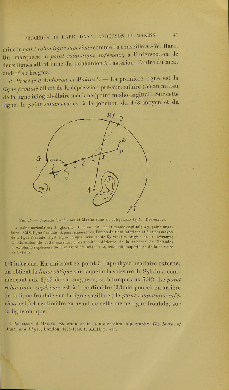 PHOGEDES DE HARE, DANA, ANDERSON ET MAKINS bine iepoint rolandique supdriear comme l'aconseille* A.-W..Hare. On marquera le point rolandique inferieur, a ['intersection de deux lignes allani l'une du stephanion a I'aste'rion, I'autre du meat auditif au bregma. d. Proetdi d'Anderson et Makins1. — La premiere ligne est la ligne frontale allant de la depression pre*-auriculaire (A) au milieu de la ligne inioglabellaire mddiane (point m6dio-sagittal). Sur cette ligne. le point squameux est a la jonction du 1/3 moyen et du Fig. -25. — Procede d'Andersoii et Makins (duo a I'obligeance de M. Decressacj. A. point auriculaire; G, glabello; I, inion; MS, point medio-sagittal; Kg, point angu- laire; AMS, ligne frontale; S, point squameux a l'union du tiers inferieur et du tiers moyen de la ligne frontale; AgP, ligne oblique, scissure de Sylvius; a, origino de la scissure ; 6. bifurcation de cette scissure; c, extremity inferieure de la scissuro de Rolando; d, extr£mit6 sup6rieure de la scissuro de Rolando; e, extremity superieure do la scissuro dc Sylvius. I :i inferieur. En unissant ce point a I'apophyse orbitaire externe, on obtient la ligne oblique sur Laquelle la scissure de Sylvius, cora- meneant aux 5/12 tie sa longueur, se bifurque aux 7/12. Le point rolandique superieur est a 1 centimetre (3/8 de policed en arriere de la ligne frontale sur la ligne sagittale ; le point rolandique infe- rieur est a 1 centimetre en avant do. cello meme ligne frontale, sur la ligne oblique l. Anderson et Makins, Experiments in cranto-cerebnil topography. The Journ. of Anat. and Phys., London, 1888-1889, I. XXIII, p. 458.