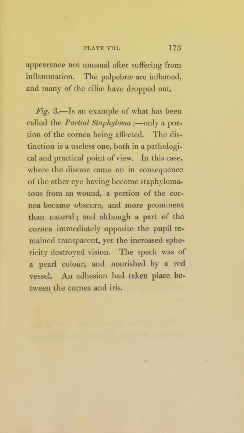 appearance not unusual after suffering from inflammation. The palpebrse are inflamed, and many of the ciliae have dropped out. Fig. 3.—Is an example of what has been called the Partial Staphyloma;—only a por¬ tion of the cornea being affected. The dis¬ tinction is a useless one, both in a pathologi¬ cal and practical point of view. In this case, where the disease came on in consequence of the other eye having become staphyloma- toiis from an wound, a portion of the cor¬ nea became obscure, and more prominent than natural; and although a part of the cornea immediately opposite the pupil re¬ mained transparent, yet the increased sphe¬ ricity destroyed vision. The speck was of a pearl colour, and nourished by a red vessel. An adhesion had taken place be¬ tween the cornea and iris.
