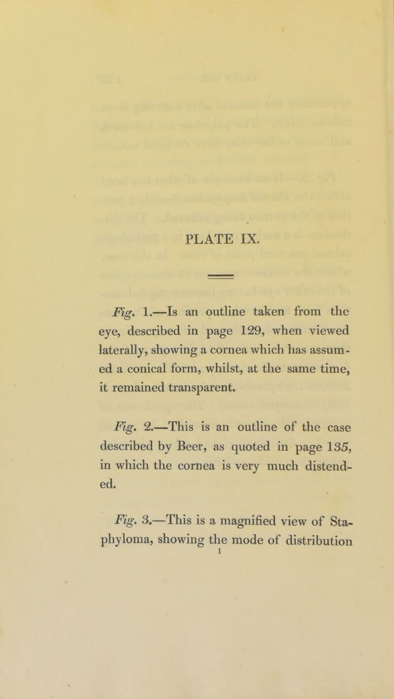 Fis* 1.—Is an outline taken from the eye, described in page 129, when viewed laterally, showing a cornea which has assum¬ ed a conical form, whilst, at the same time, it remained transparent. Fig. 2.—This is an outline of the case described by Beer, as quoted in page 135, in wliich the cornea is very much distend¬ ed. Fig, 3.—This is a magnified view of Sta¬ phyloma, showing the mode of distribution