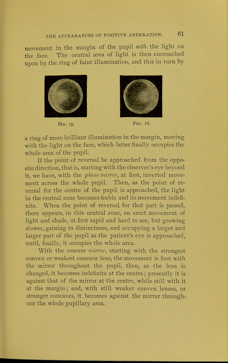 movement in the margin of the pupil with the light on the face. The central area of light is then encroached upon by the ring of faint illumination, and this in turn by Fig. 15. Fig. 16. a ring of more brilliant illumination in the margin, moving with the light on the face, which latter finally occupies the whole area of the pupil. If the point of reversal be approached from the oppo- site direction, that is, starting with the observer's eye beyond it, we have, with the plane mirror, at first, inverted move- ment across the whole pupil. Then, as the point of re- versal for the centre of the pupil is approached, the light in the central zone becomes feeble and its movement indefi- nite. When the point of reversal, for that part is passed, there appears, in this central zone, an erect movement of light and shade, at first rapid and hard to see, but growing slower, gaining in distinctness, and occupying a larger and larger part of the pupil as the patient's eye is approached, until, finally, it occupies the whole area. With the concave mirror, starting with the strongest convex or weakest concave lens, the movement is first with the mirror throughout the pupil, then, as the lens is changed, it becomes indefinite at the centre; presently it is against that of the mirror at the centre, while still with it at the margin; and, with still weaker convex lenses, or stronger concaves, it becomes against the mirror through- out the whole pupillary area.