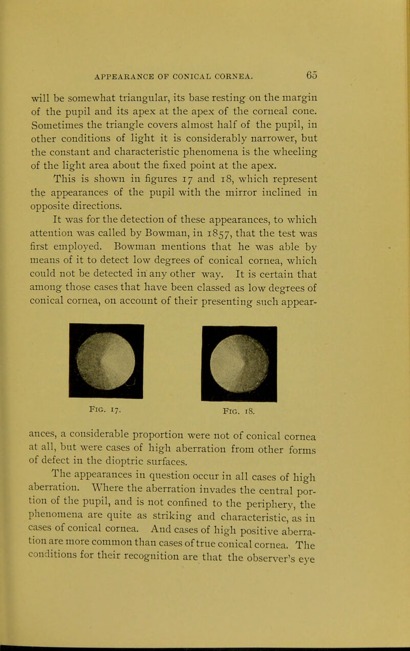 will be somewhat triangular, its base resting on the margin of the pupil and its apex at the apex of the corneal cone. Sometimes the triangle covers almost half of the pupil, in other conditions of light it is considerably narrower, but the constant and characteristic phenomena is the wheeling of the light area about the fixed point at the apex. This is shown in figures 17 and 18, which represent the appearances of the pupil with the mirror inclined in opposite directions. It was for the detection of these appearances, to which attention was called by Bowman, in 1857, that the test was first employed. Bowman mentions that he was able by means of it to detect low degrees of conical cornea, which could not be detected in any other way. It is certain that among those cases that have been classed as low degrees of conical cornea, on account of their presenting such appear- Fig. 17. Fig. 18. ances, a considerable proportion were not of conical cornea at all, but were cases of high aberration from other forms of defect in the dioptric surfaces. The appearances in question occur in all cases of high aberration. Where the aberration invades the central por- tion of the pupil, and is not confined to the periphery, the phenomena are quite as striking and characteristic, as in cases of conical cornea. And cases of high positive aberra- tion are more common than cases of true conical cornea. The conditions for their recognition are that the observer's eve